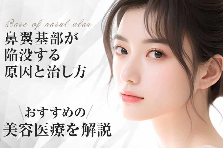 鼻翼基部　陥没