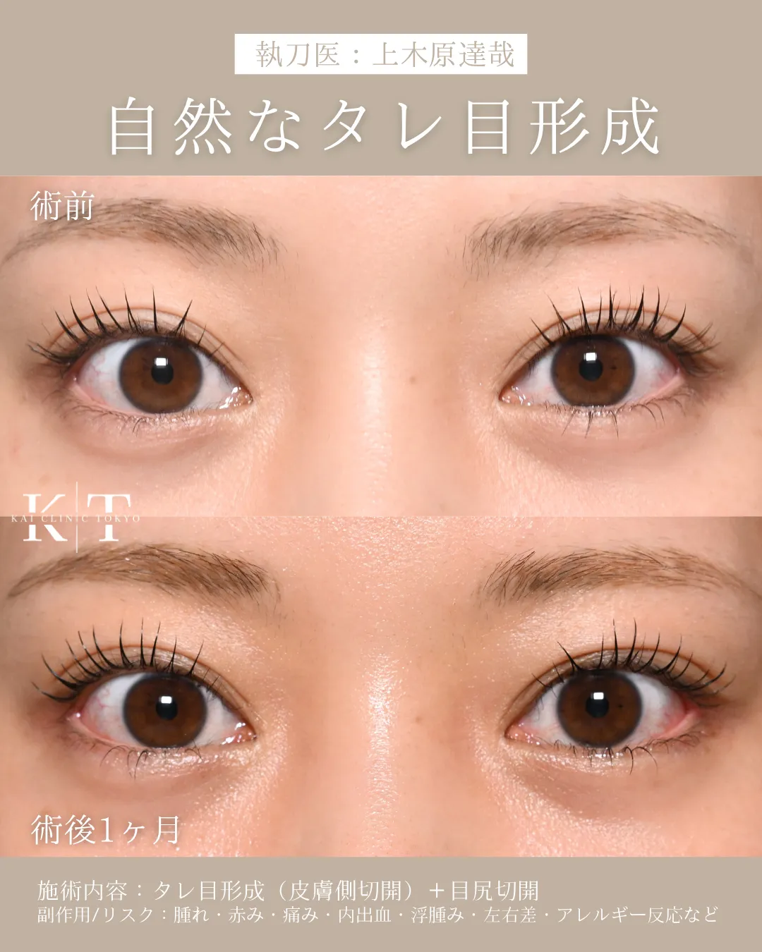 症例メディア