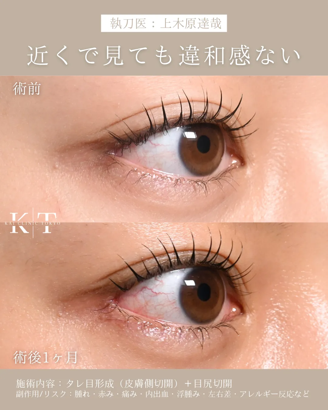症例メディア