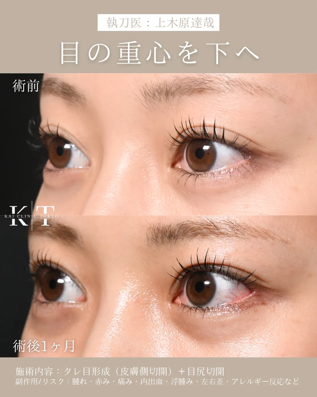 症例メディア