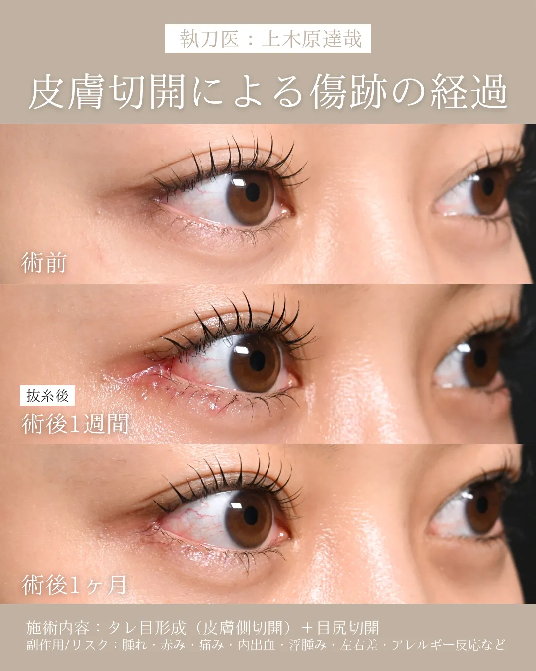 症例メディア