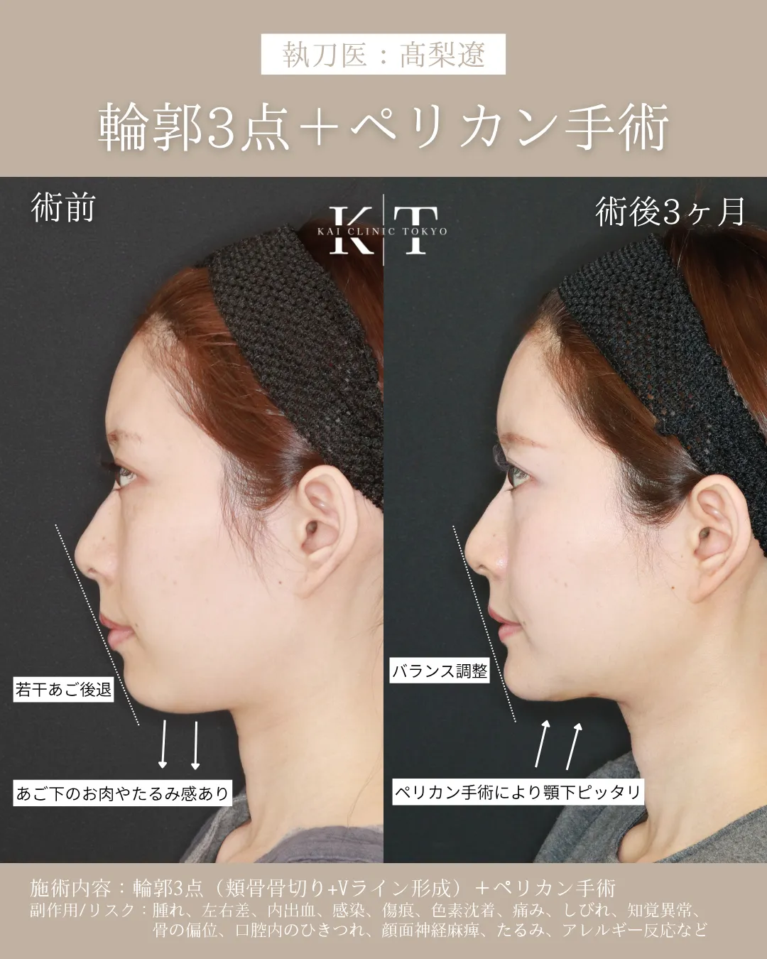 症例メディア