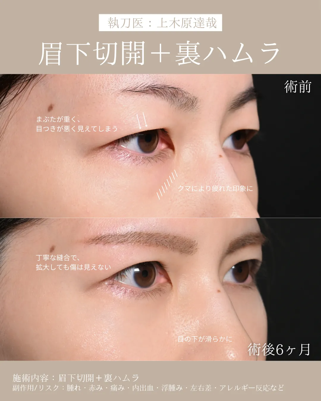 症例メディア