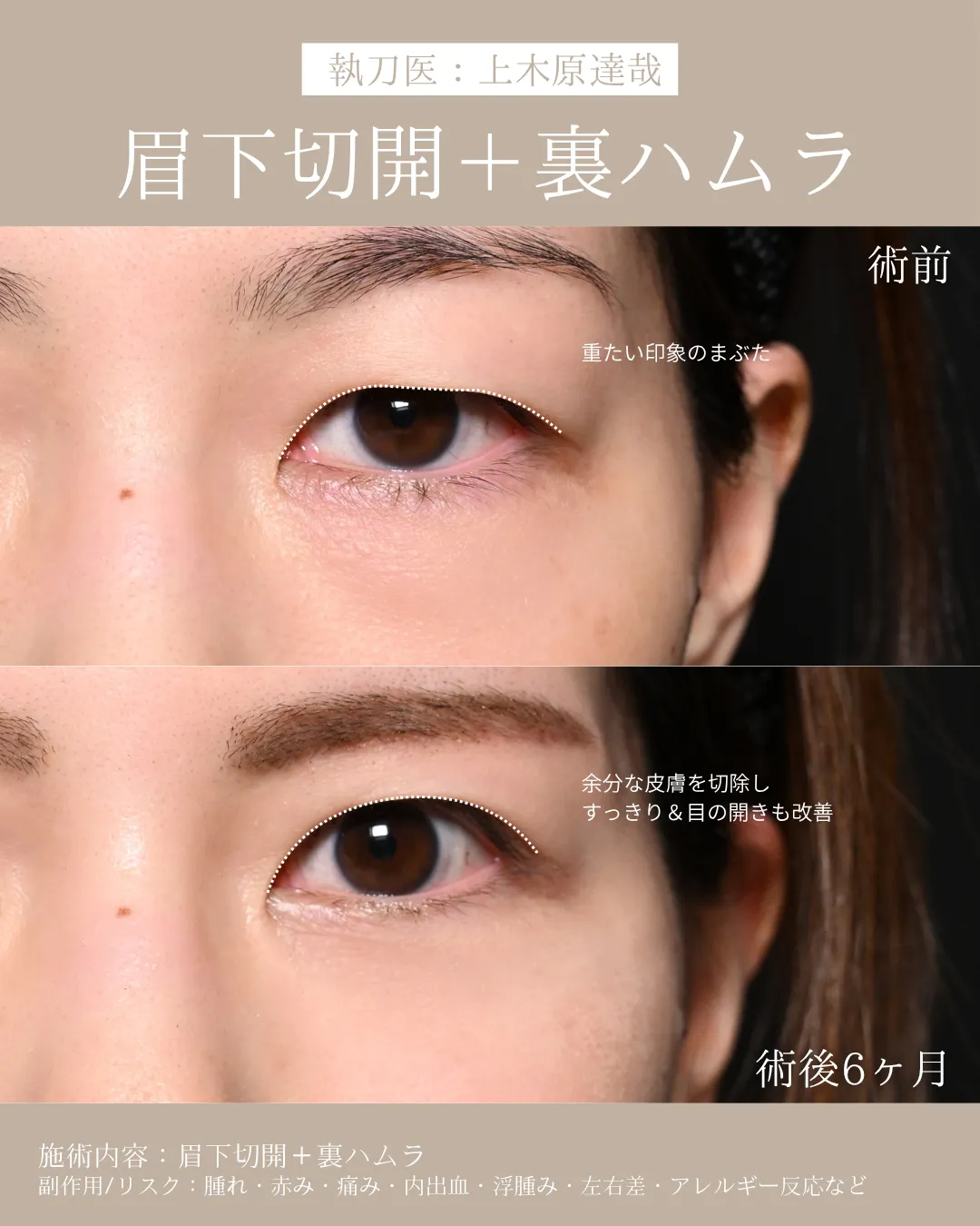 症例メディア