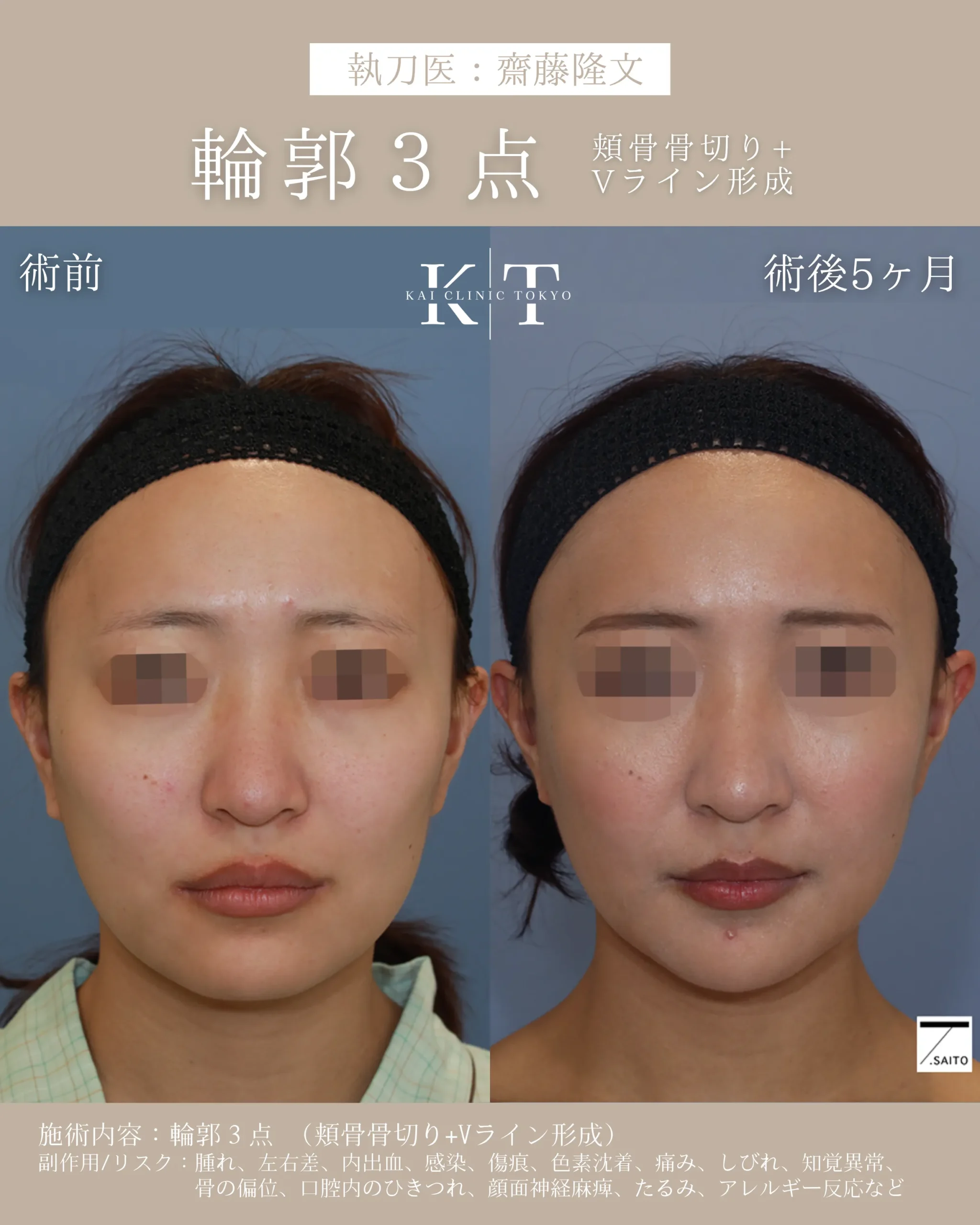 輪郭3点【20代女性】