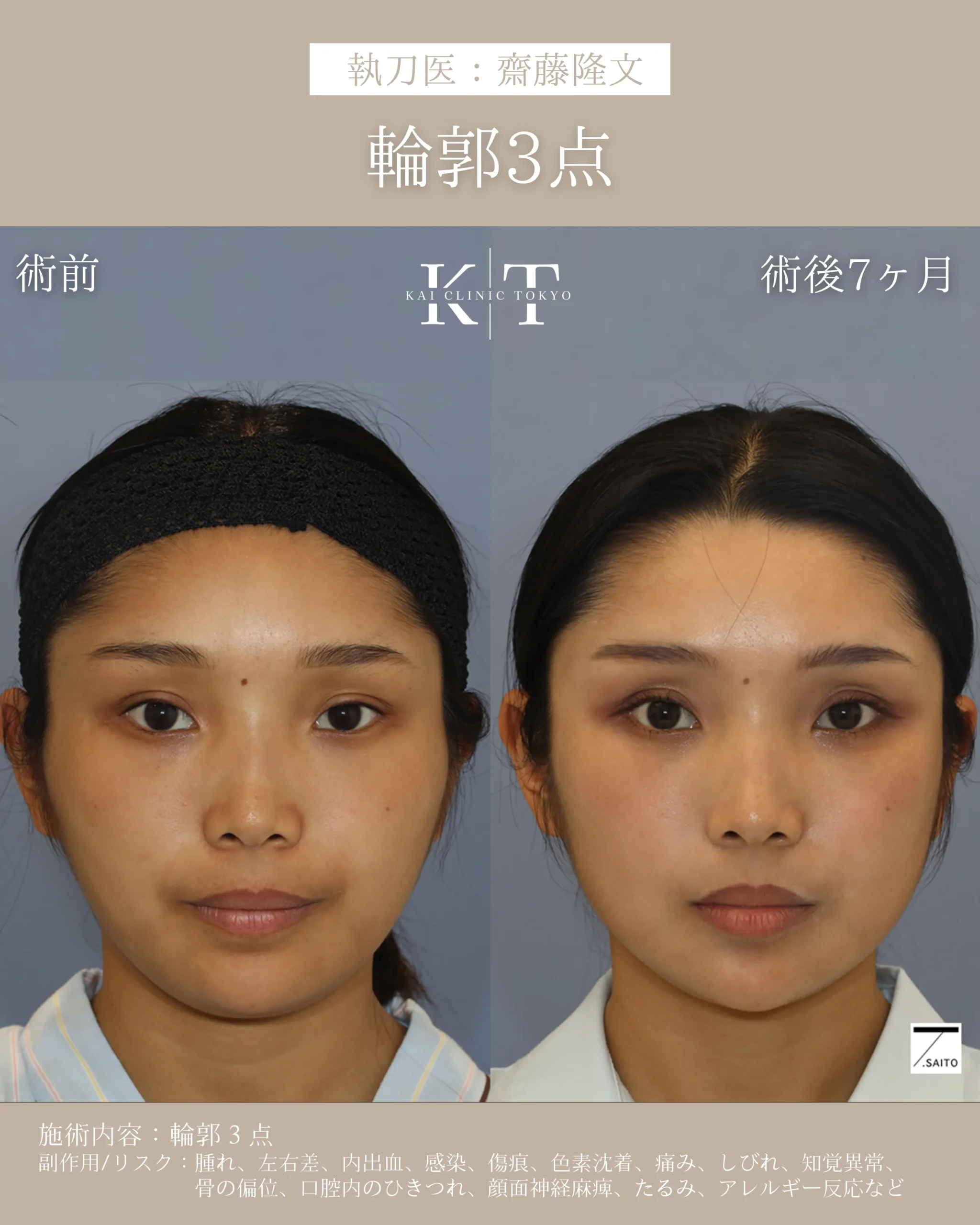 輪郭3点【20代女性】
