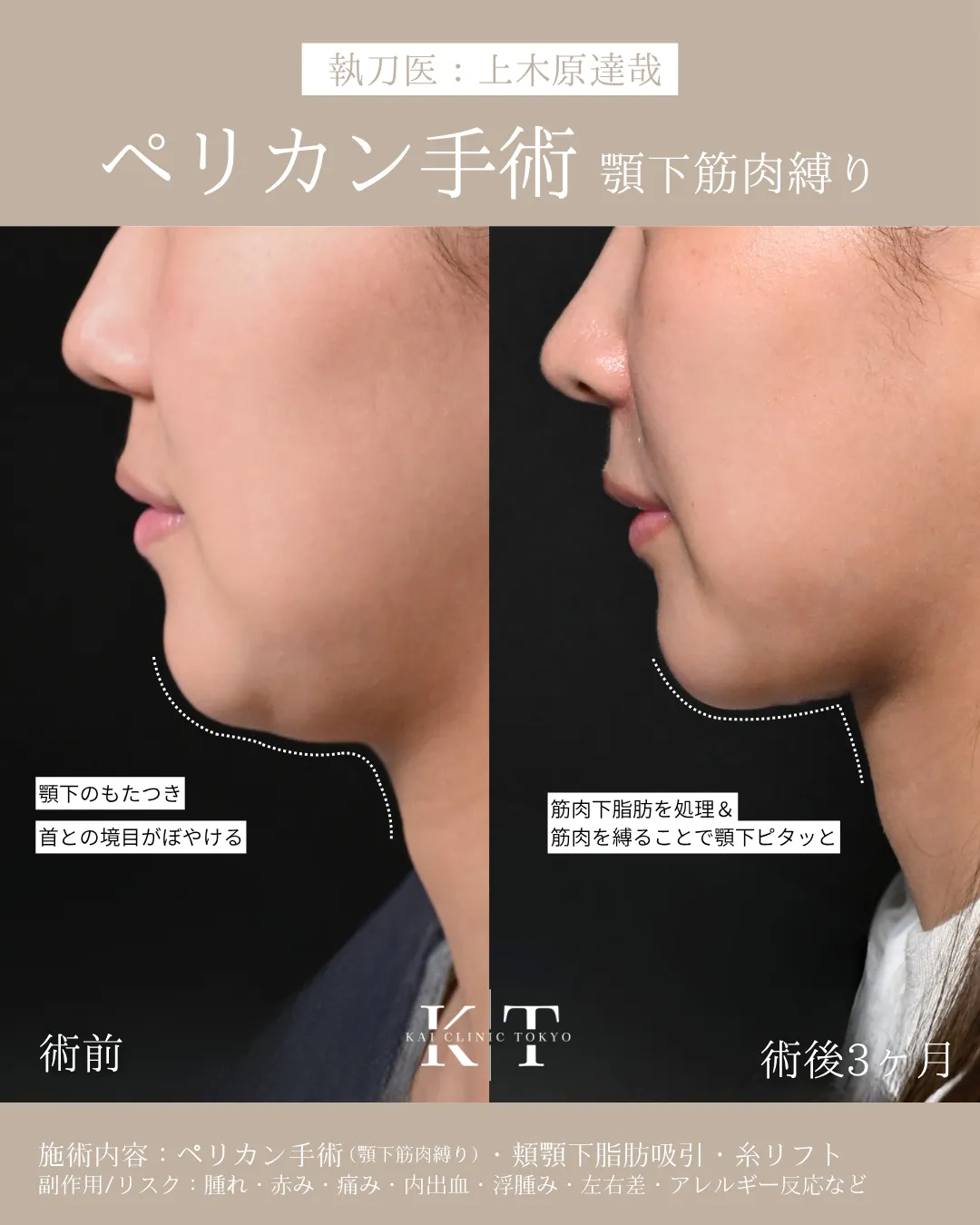 症例メディア
