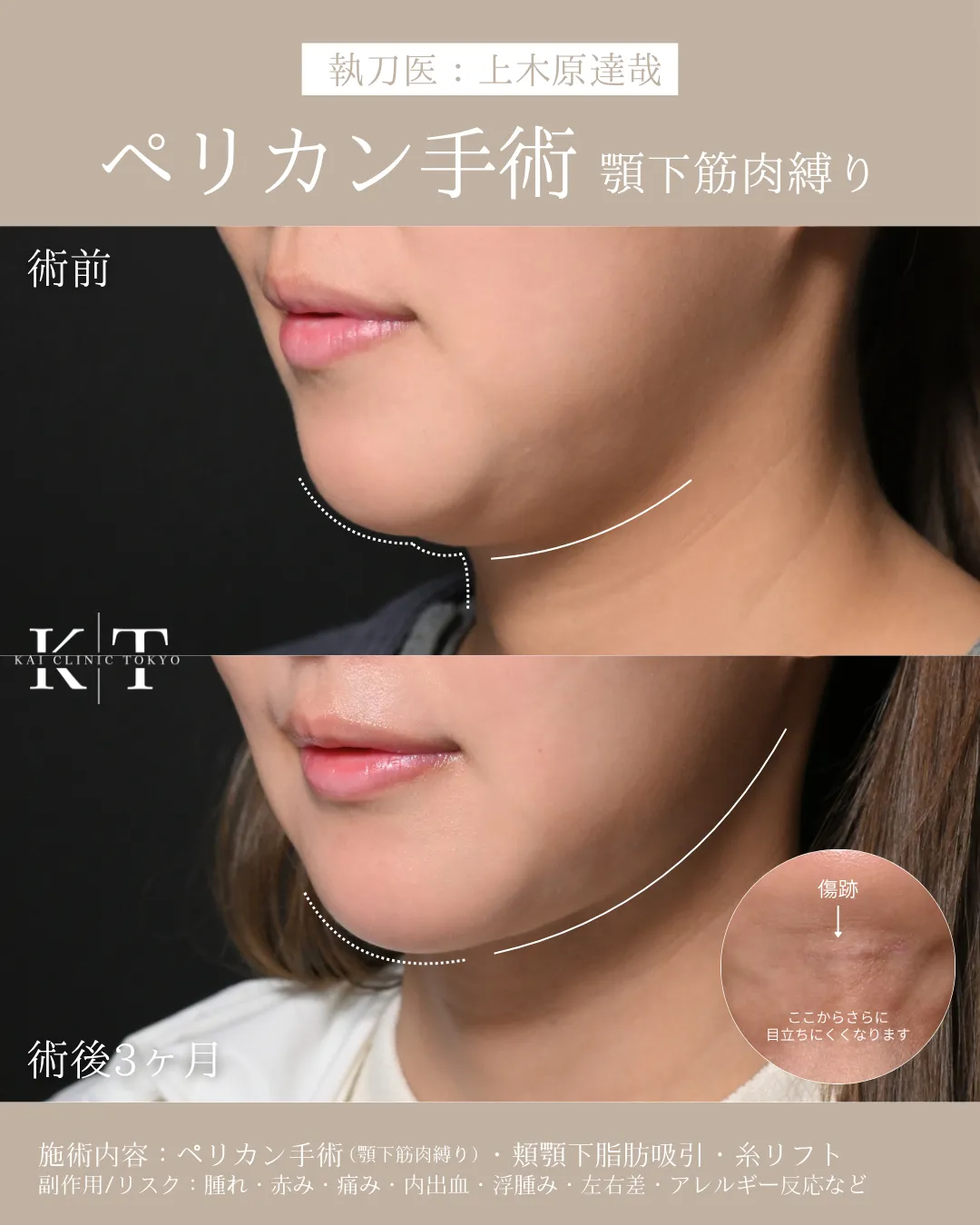 症例メディア