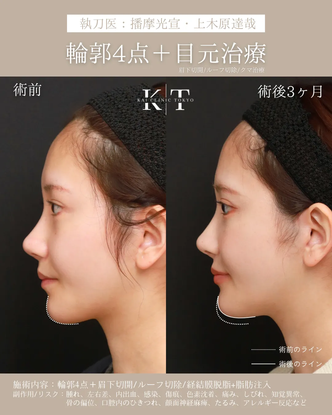 症例メディア