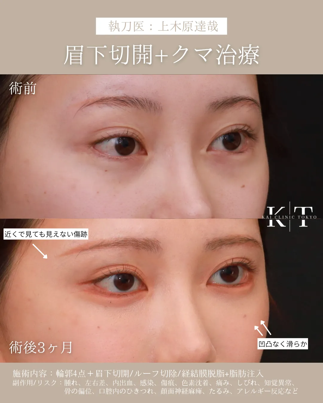 症例メディア