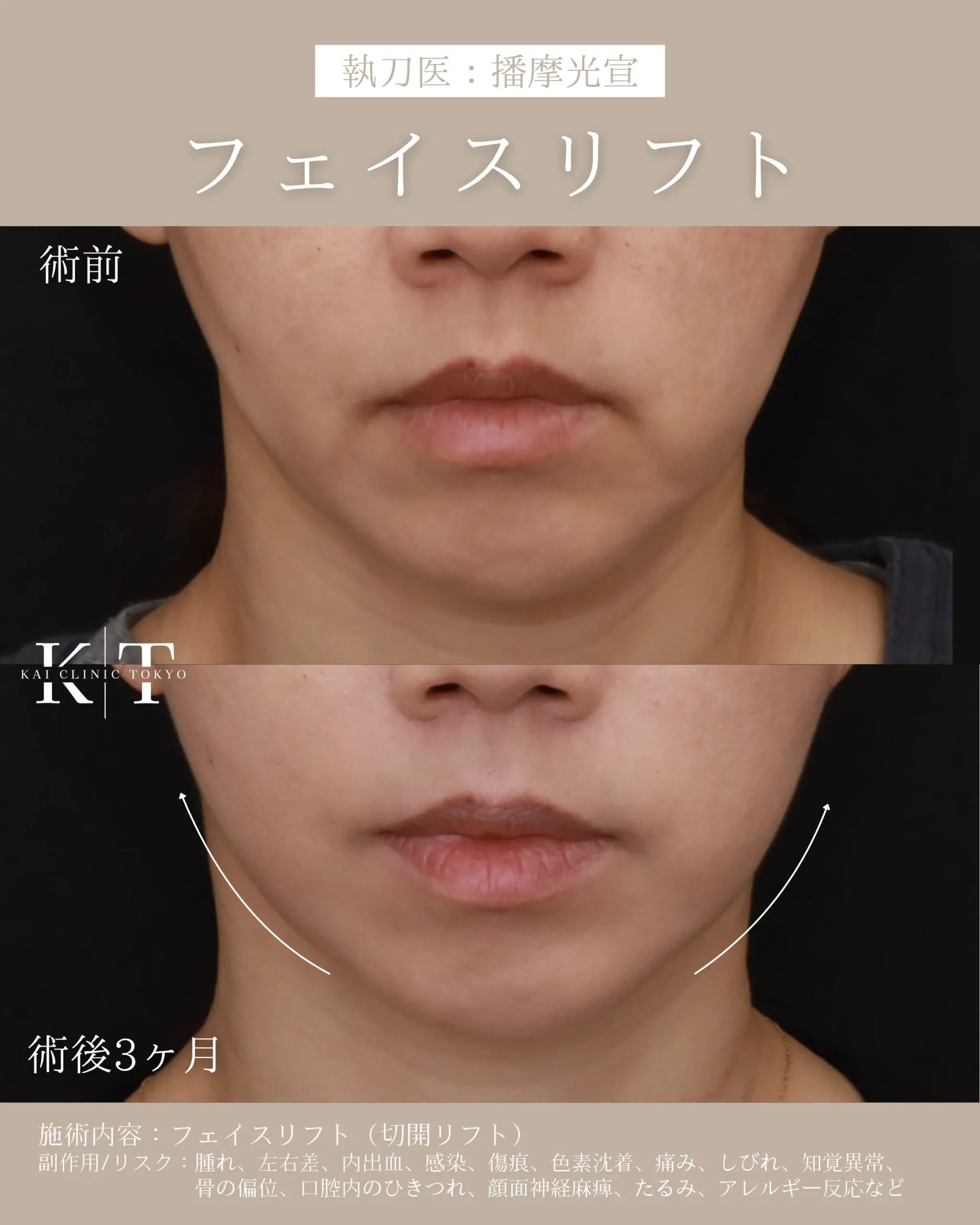 症例メディア
