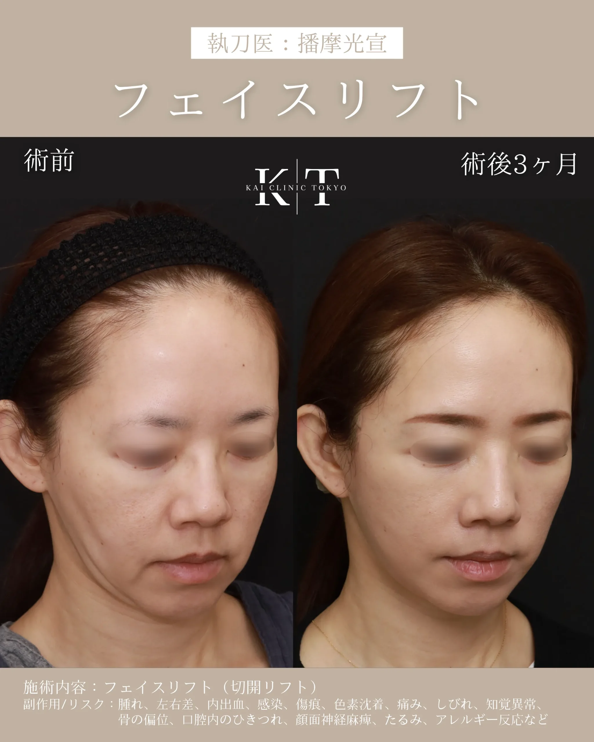 症例メディア