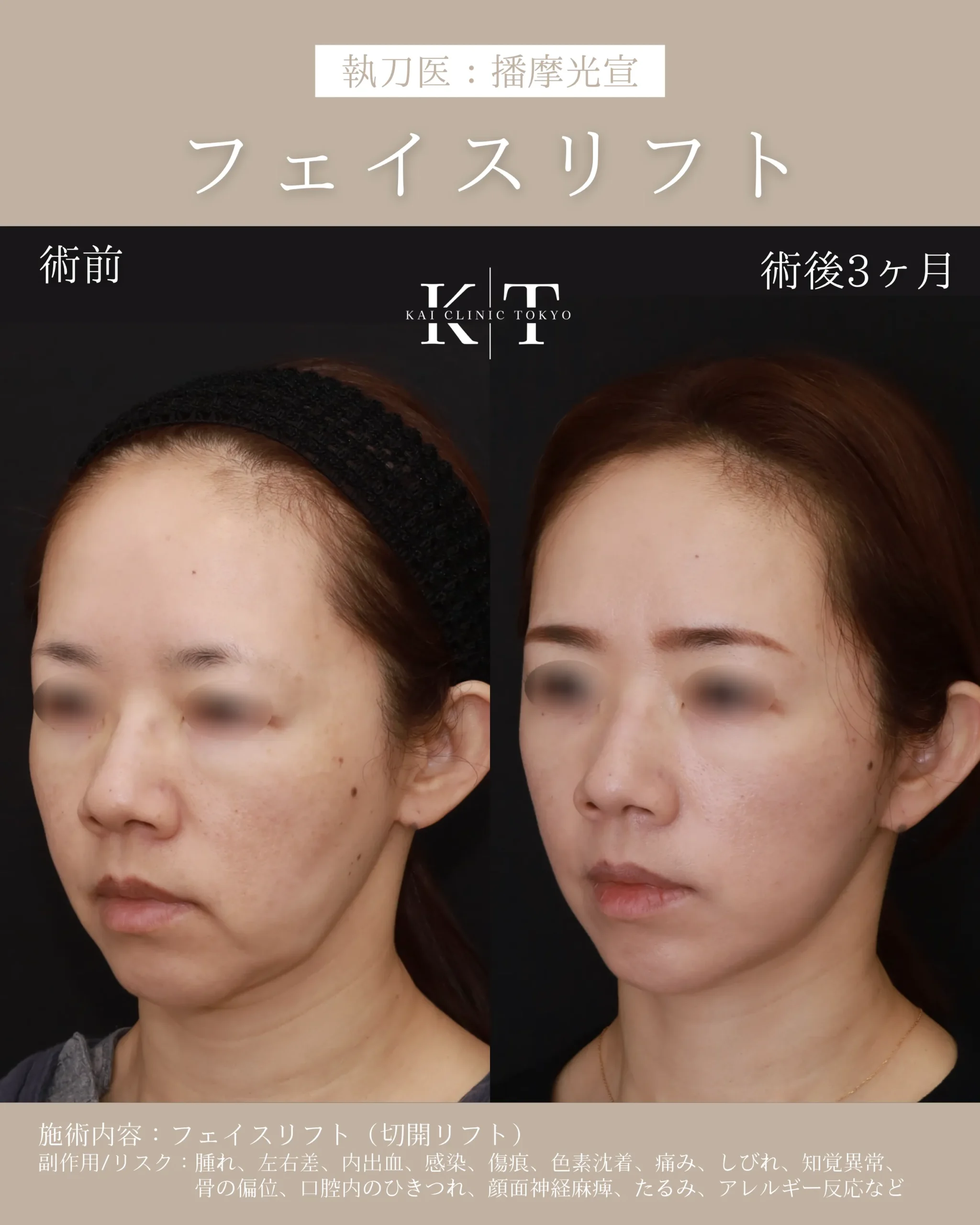 症例メディア