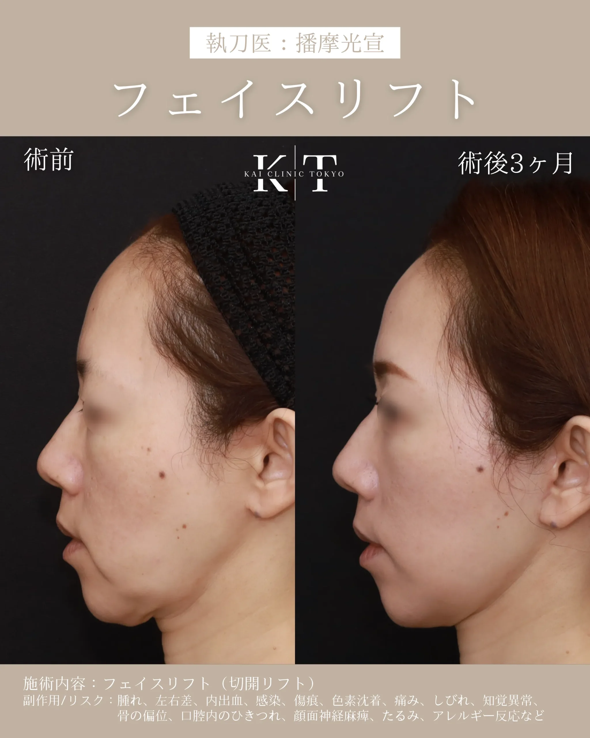 症例メディア