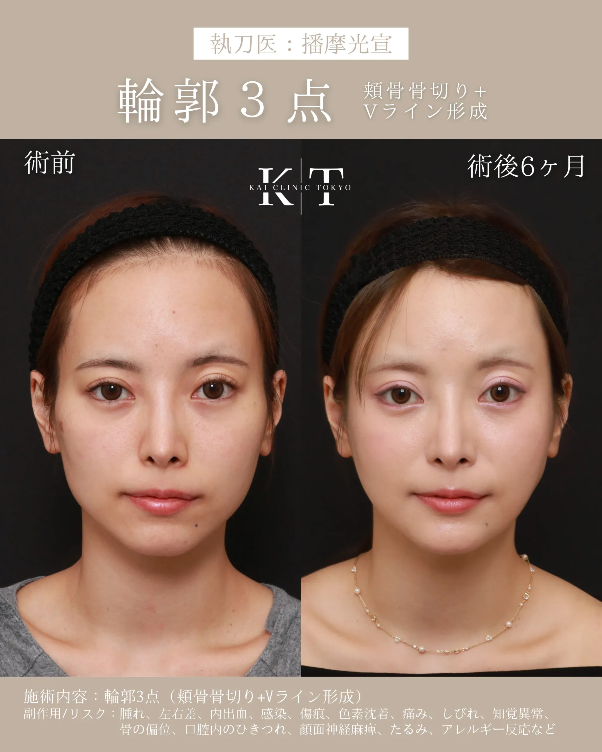 輪郭3点【20代女性】