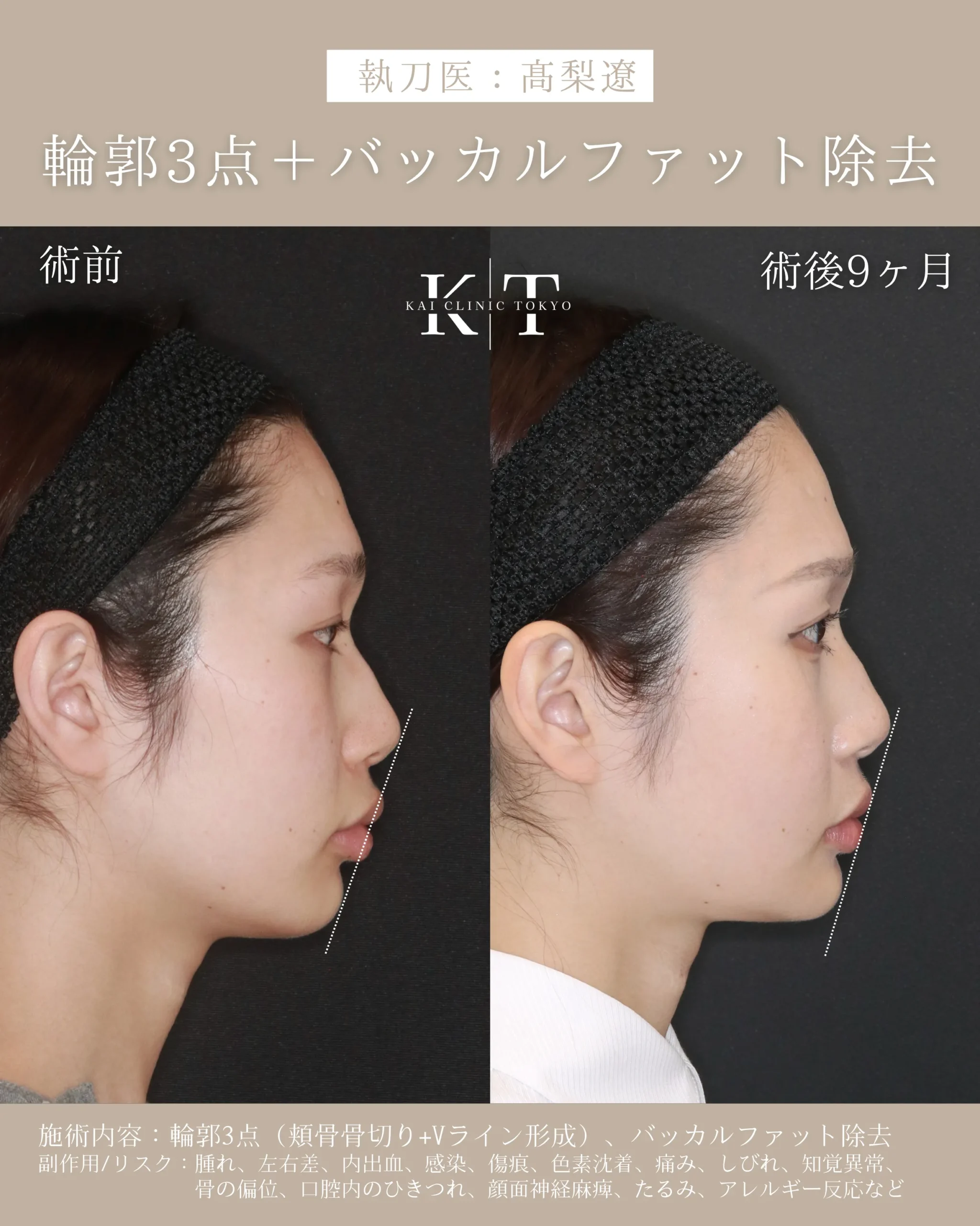 症例メディア