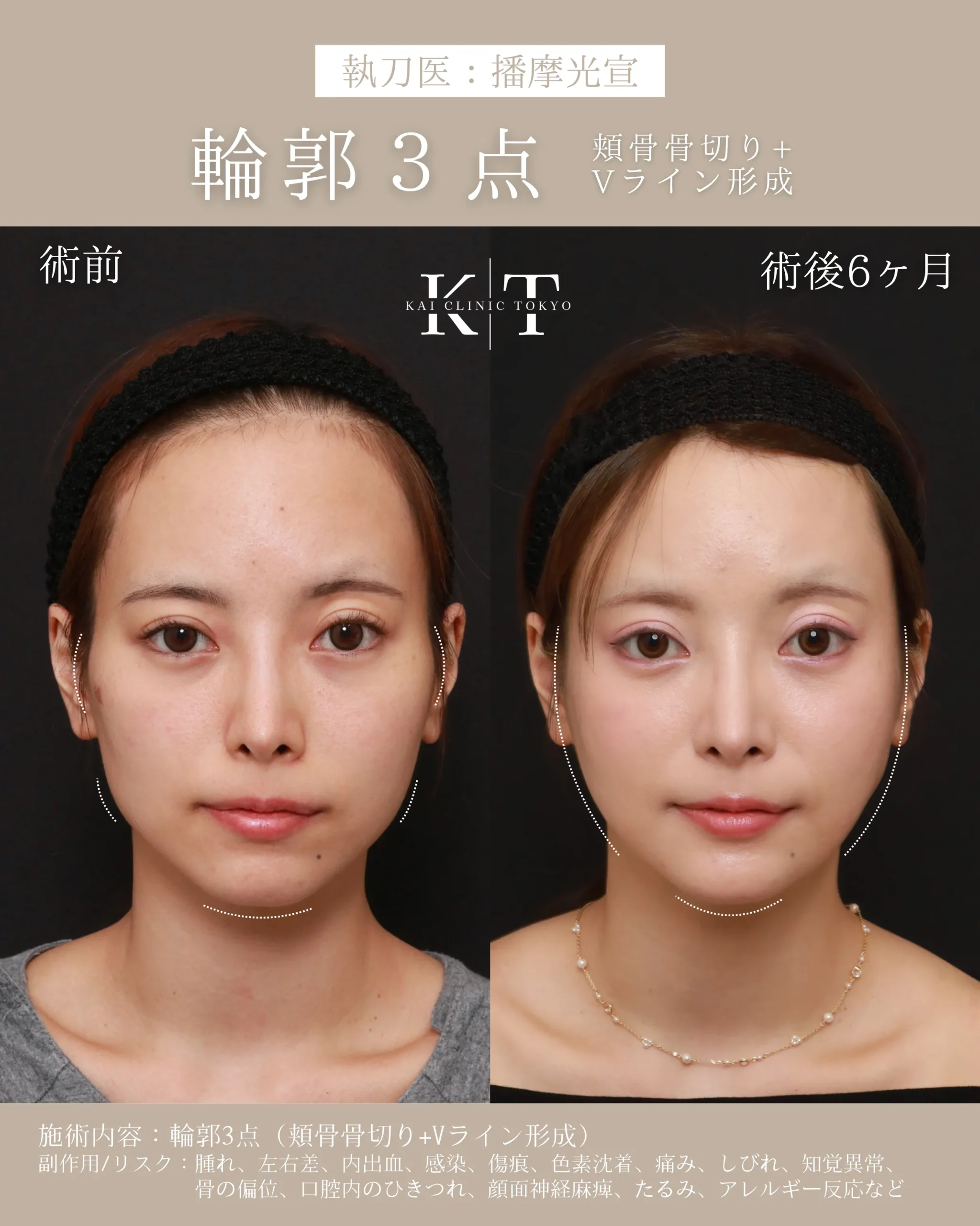 症例メディア