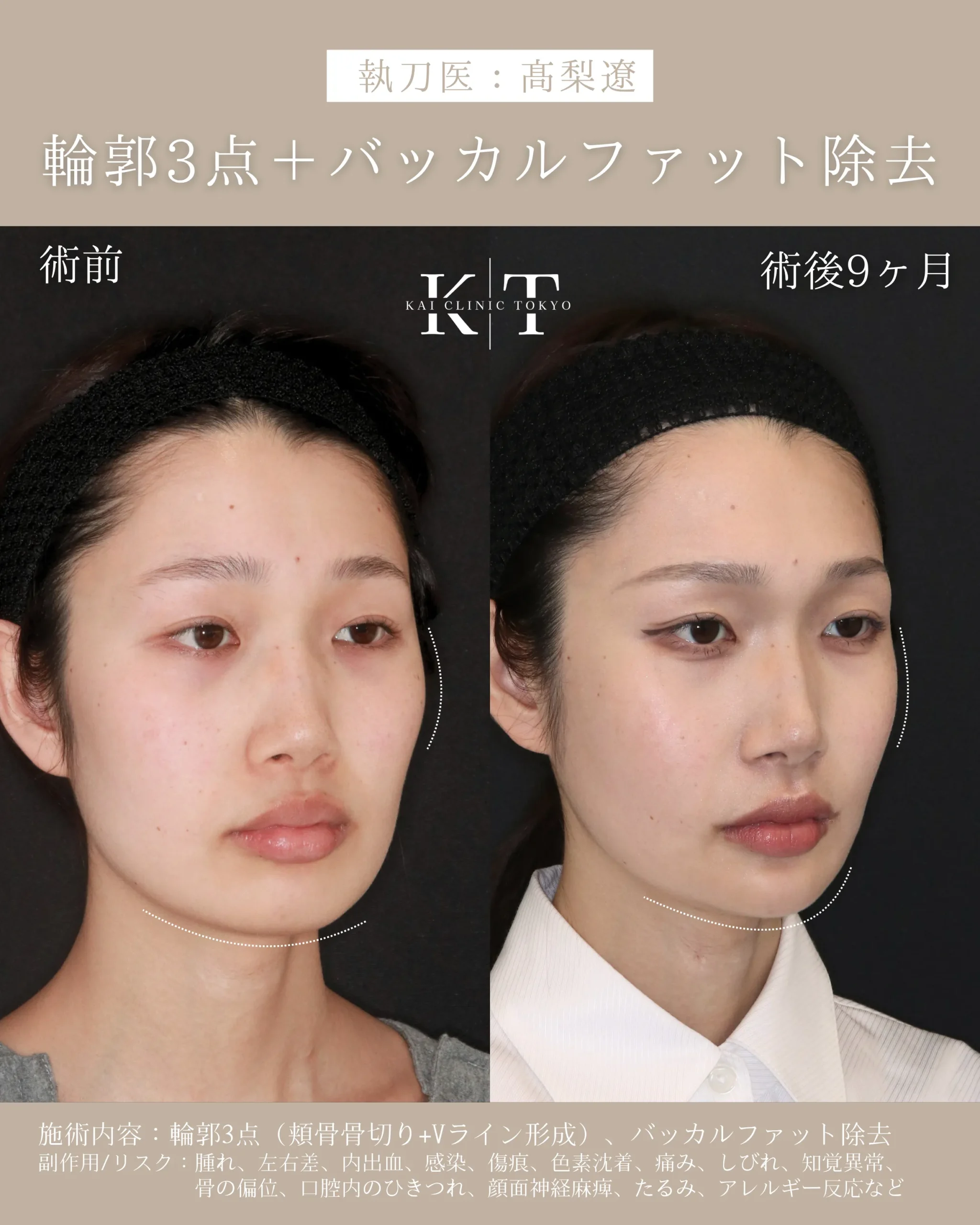 症例メディア