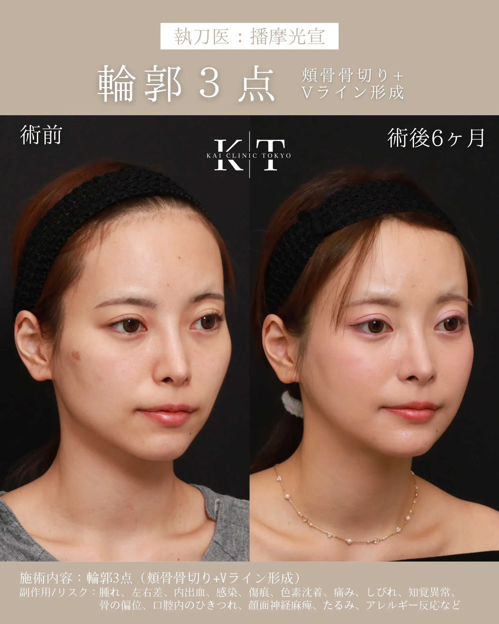 症例メディア