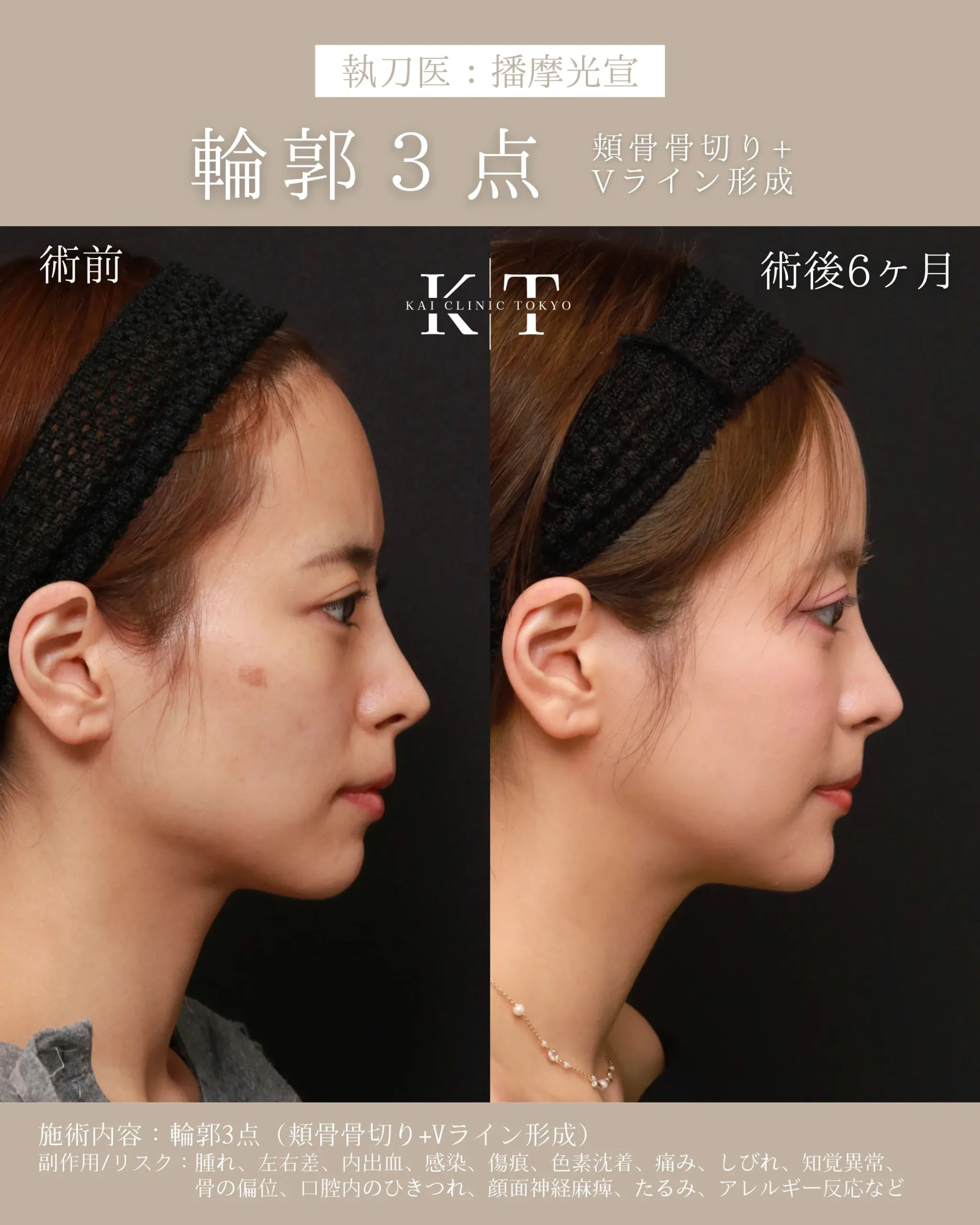 症例メディア