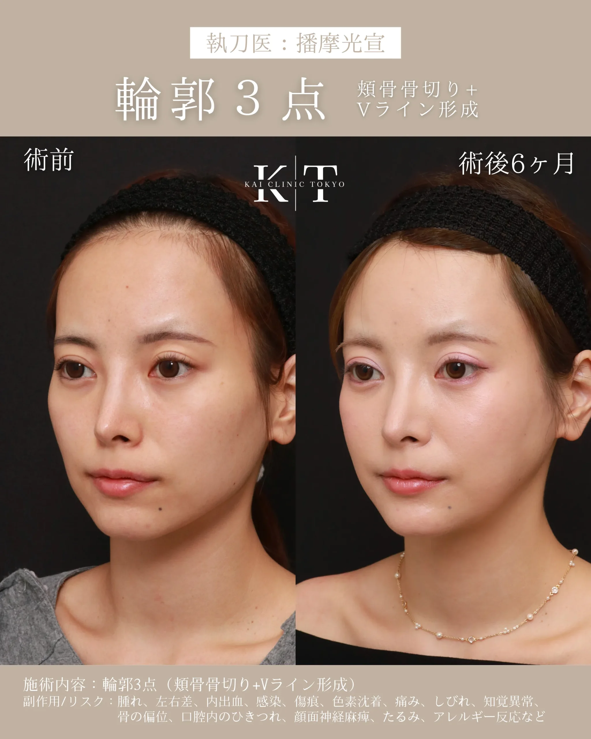 症例メディア