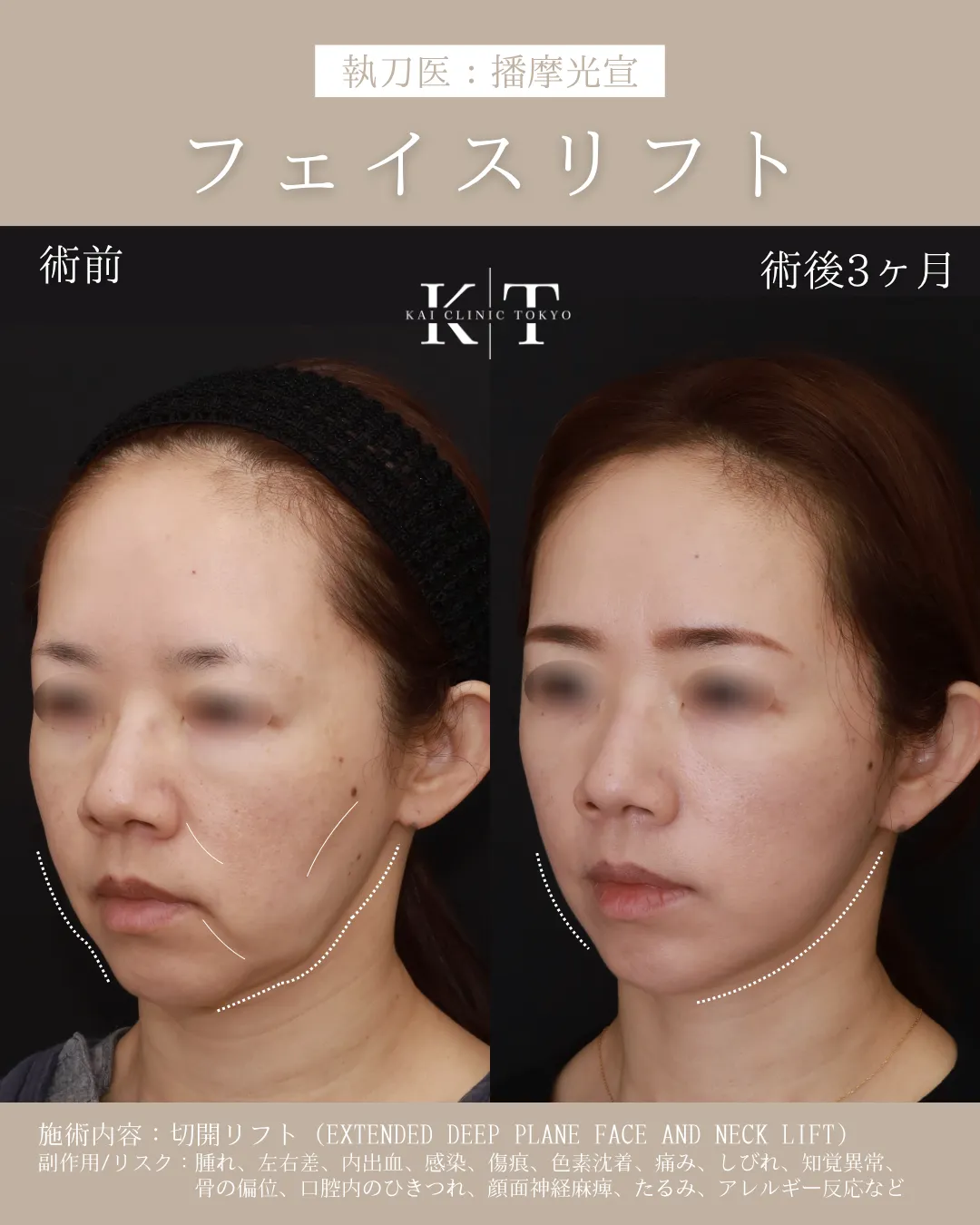 症例メディア