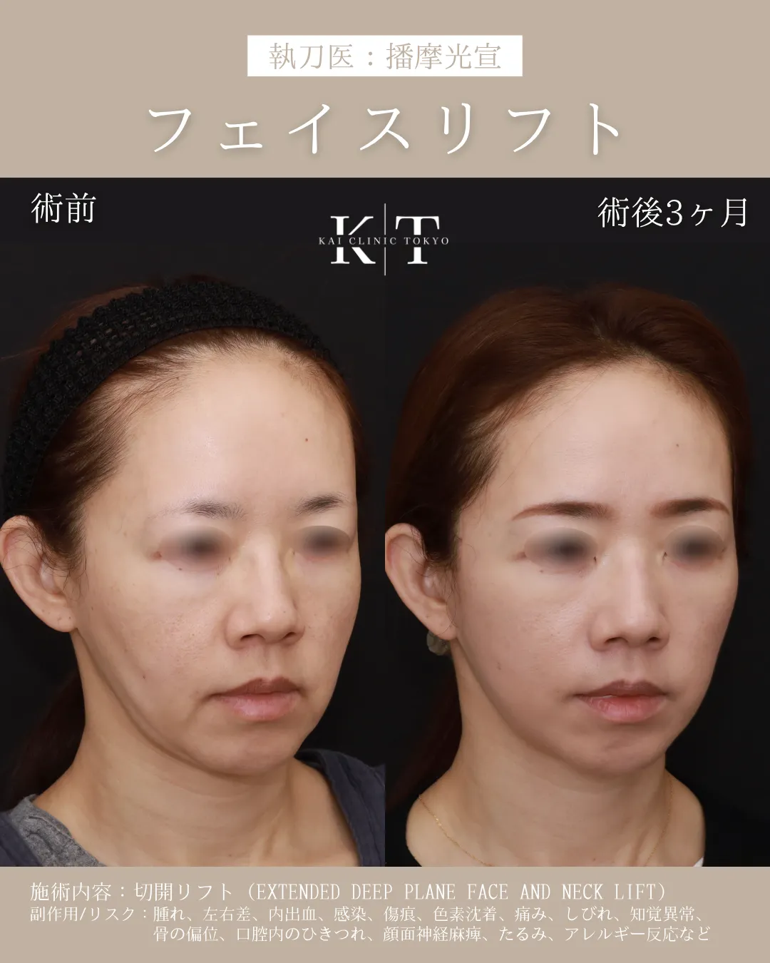 症例メディア