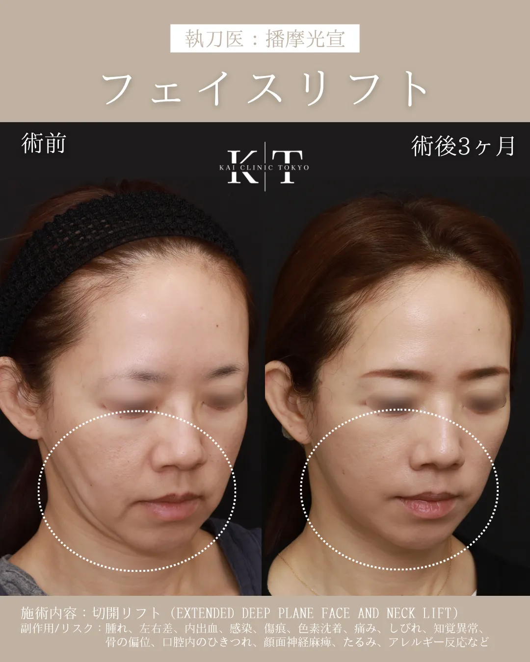 症例メディア
