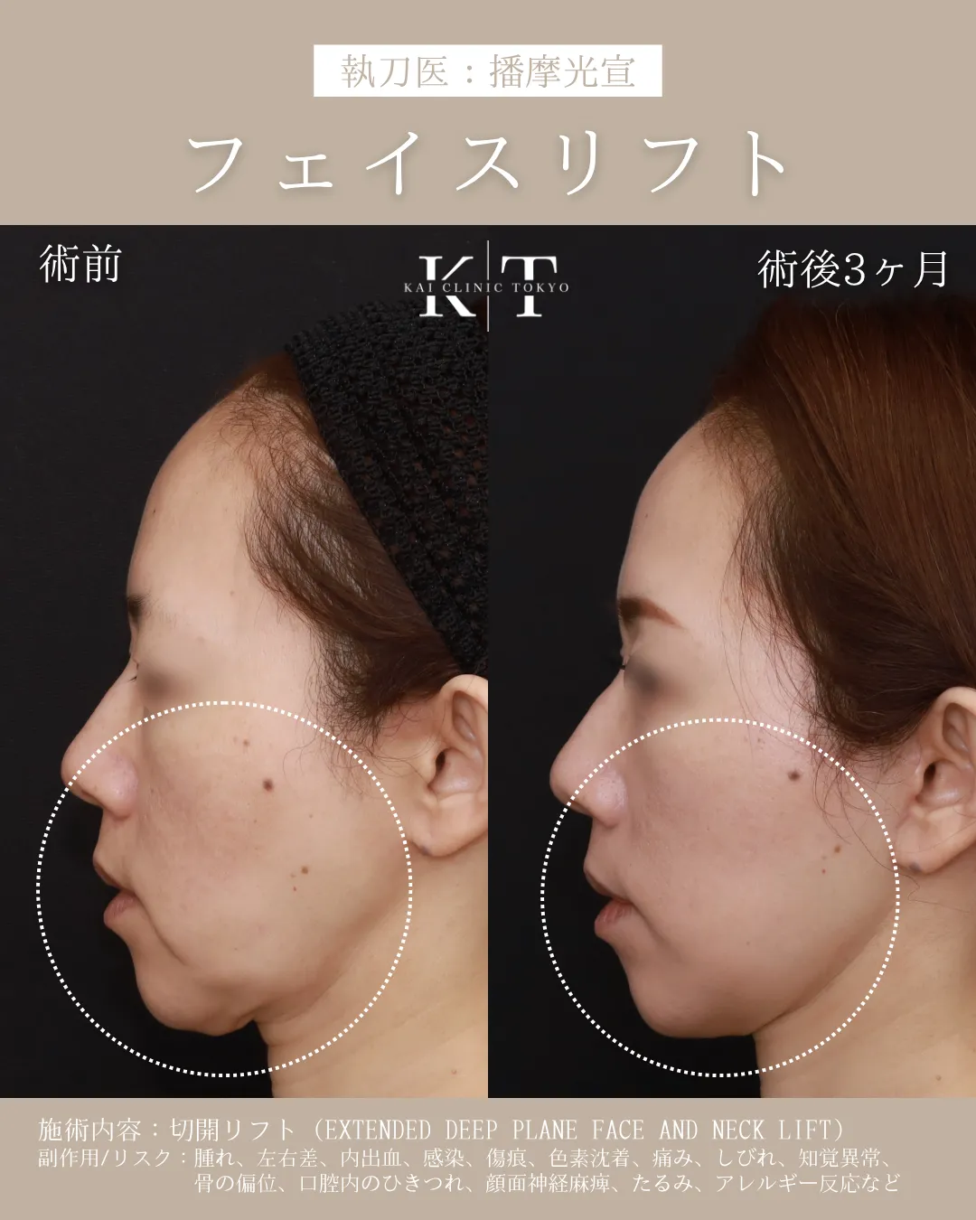 症例メディア