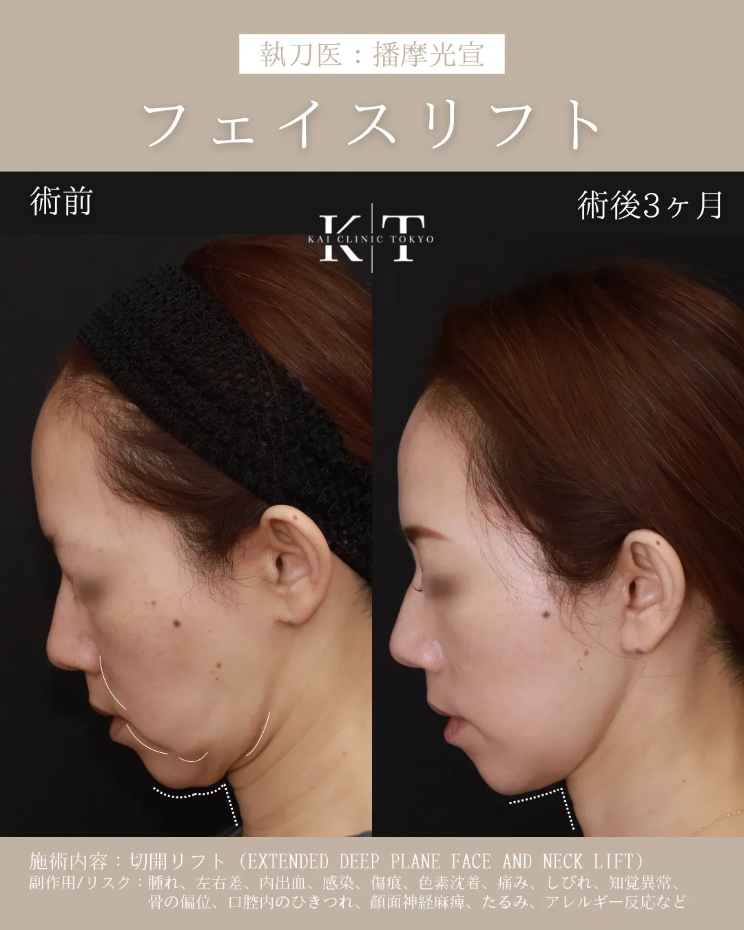 症例メディア
