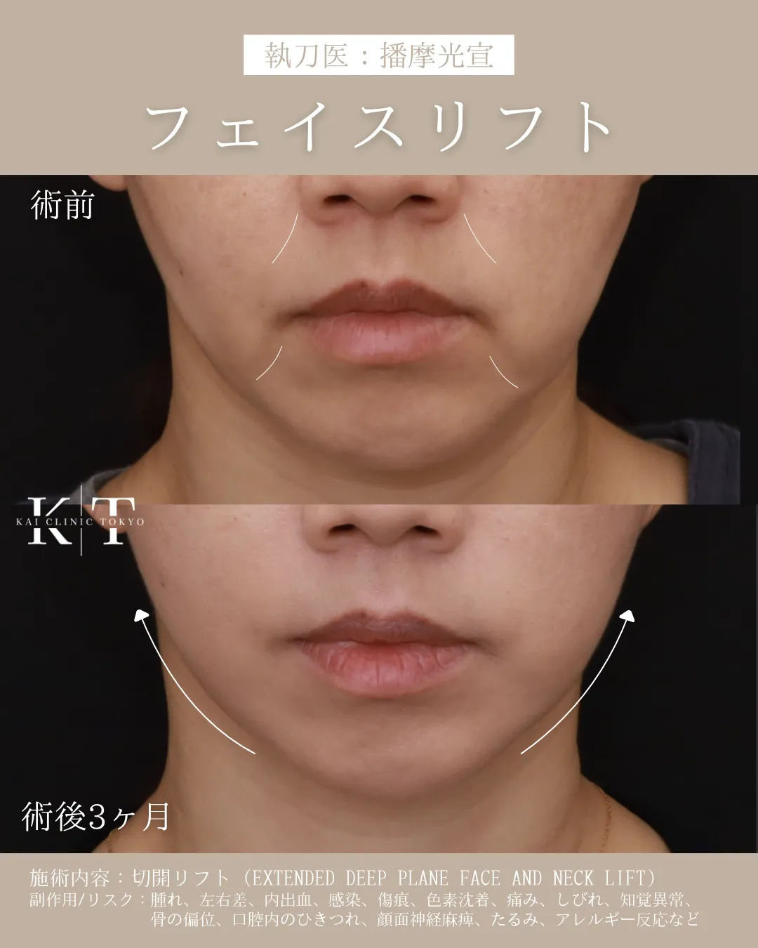 症例メディア