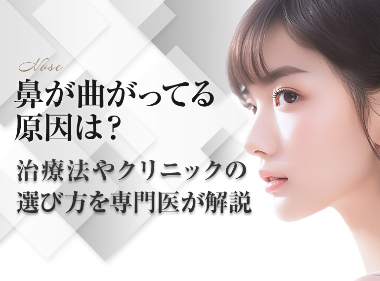 鼻　曲がってる