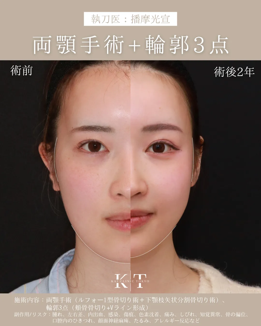 症例メディア