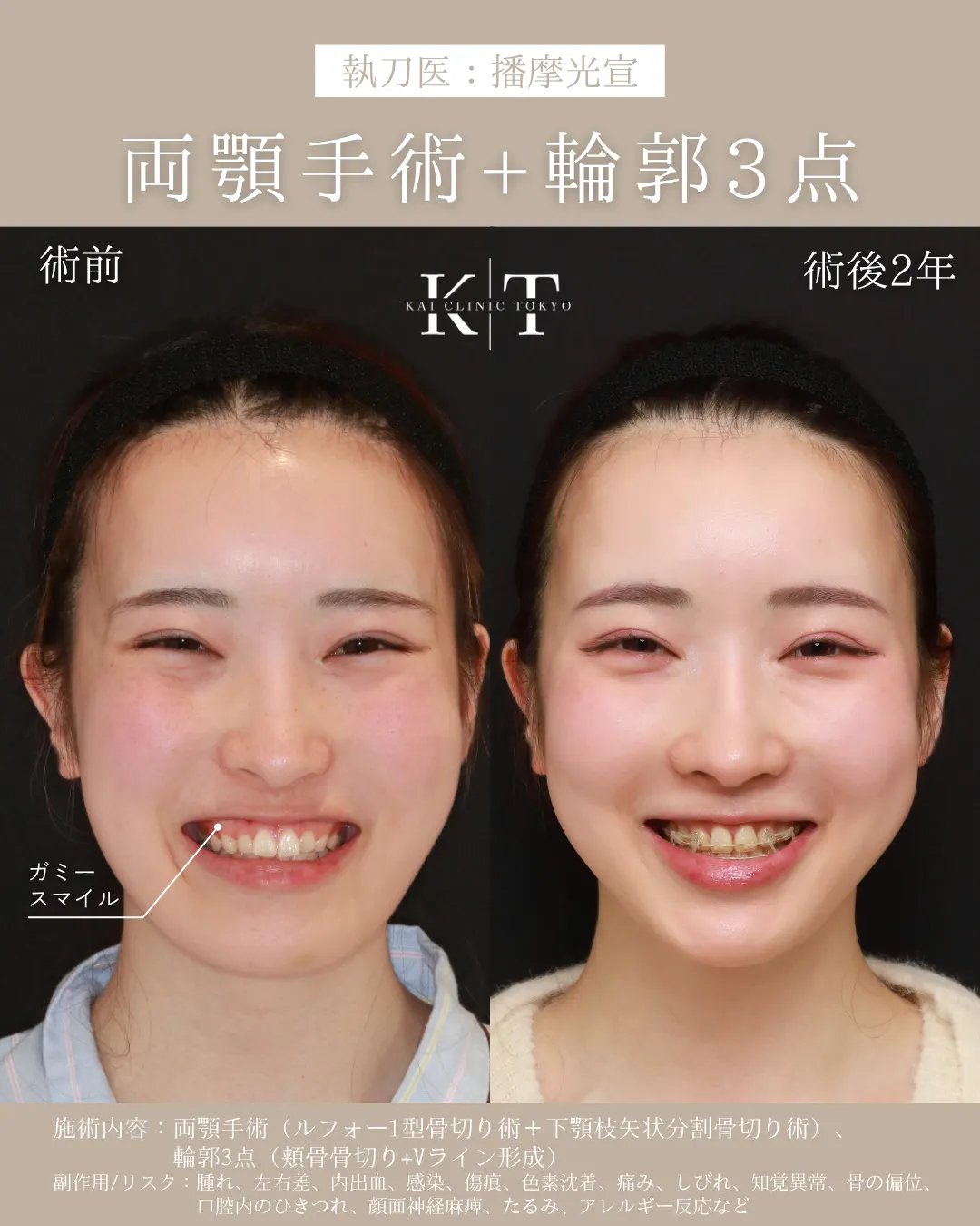 症例メディア