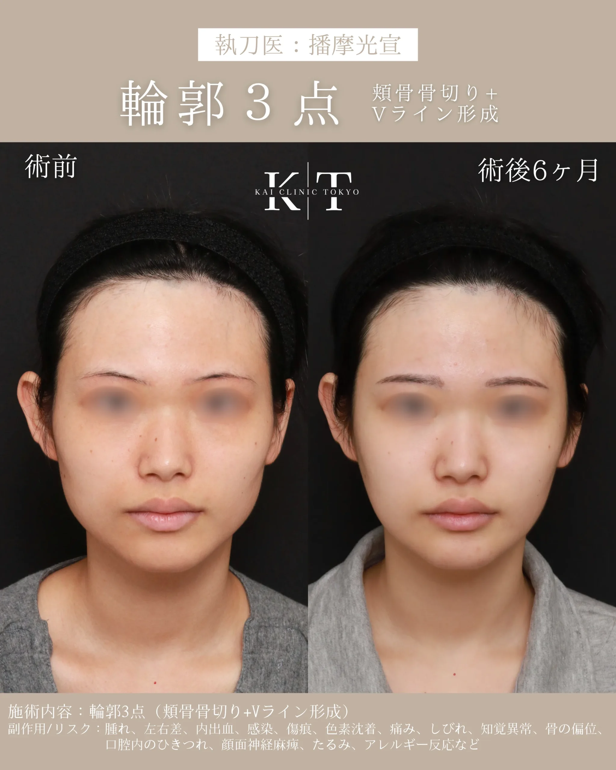輪郭3点【20代女性】