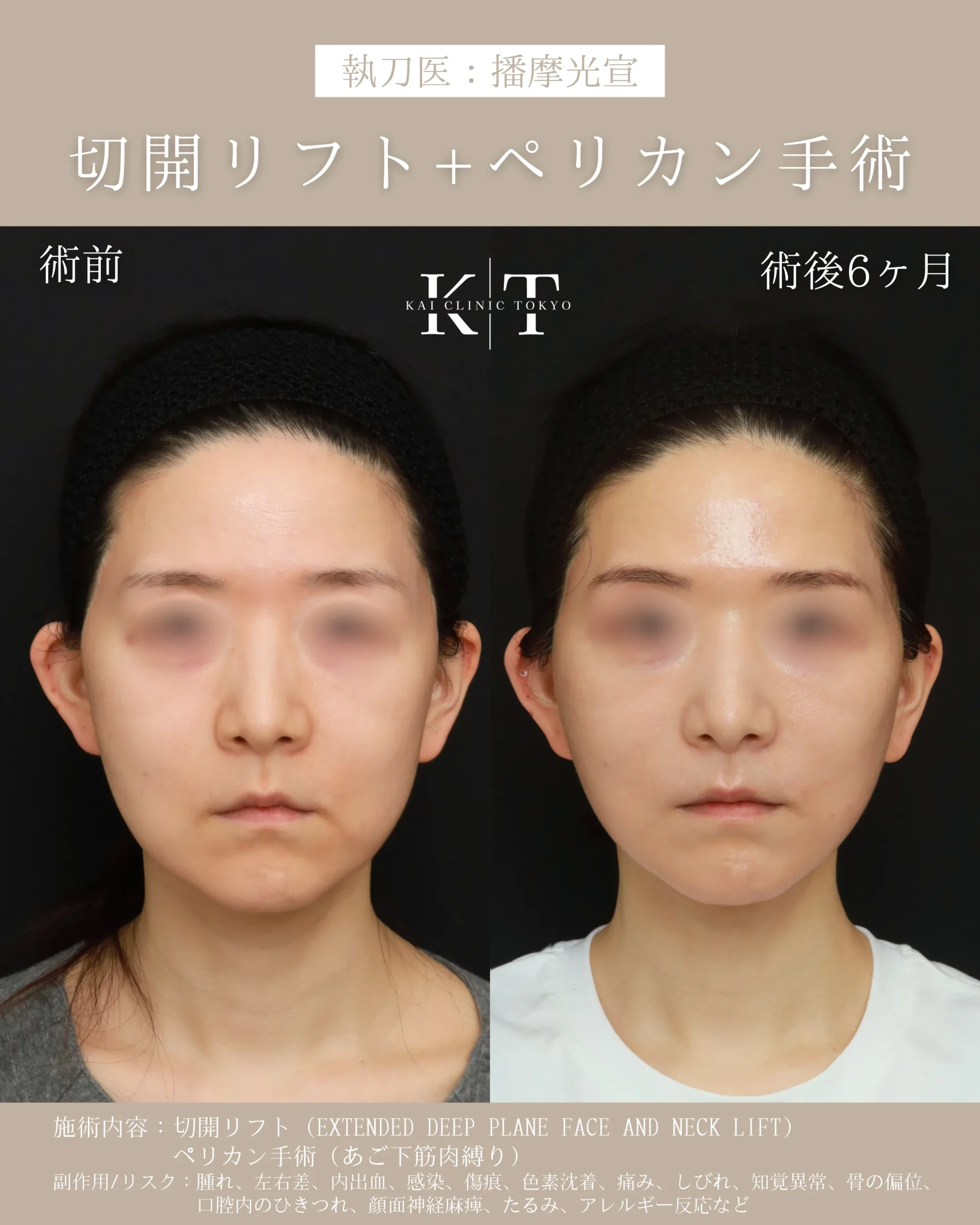 症例メディア