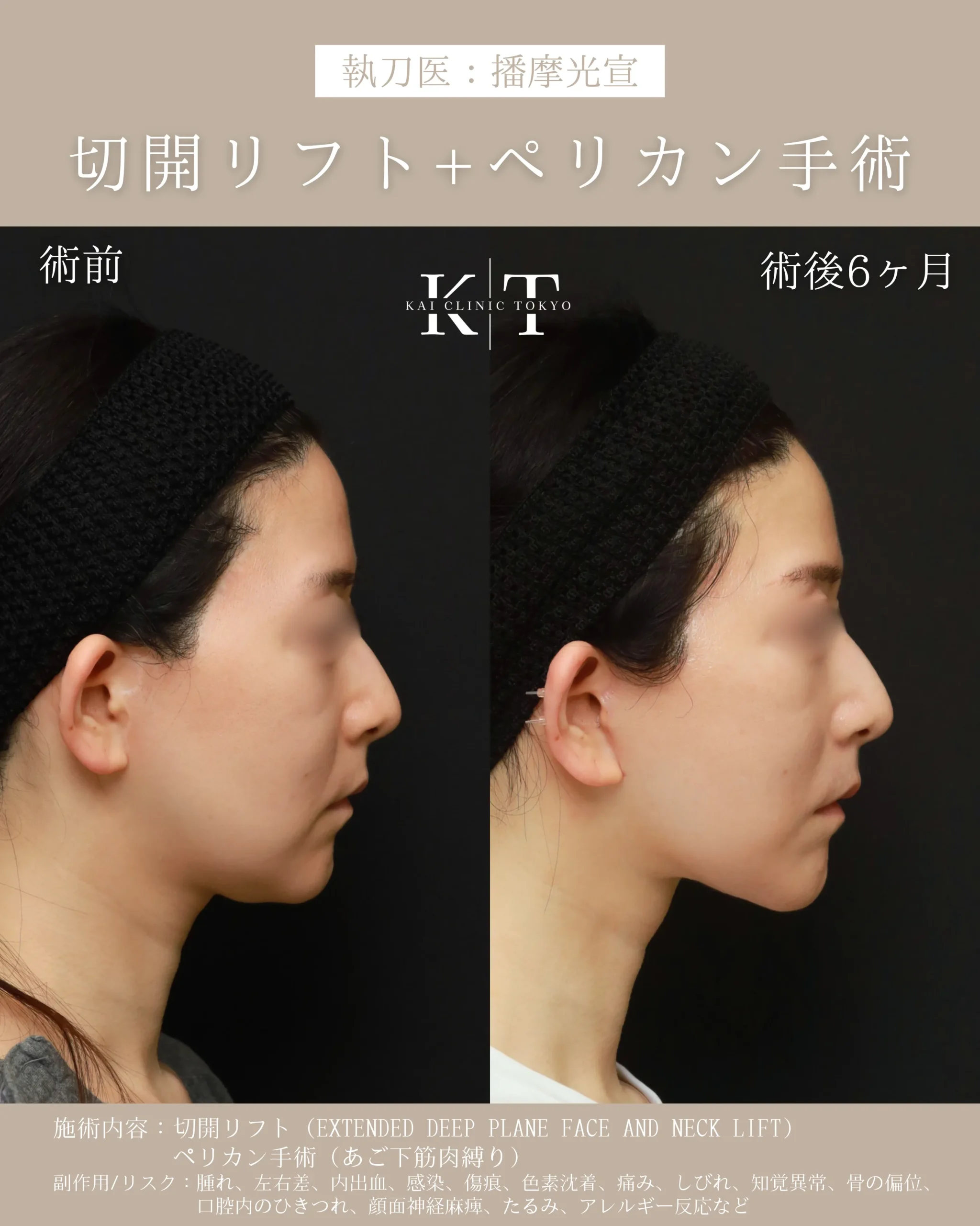 症例メディア