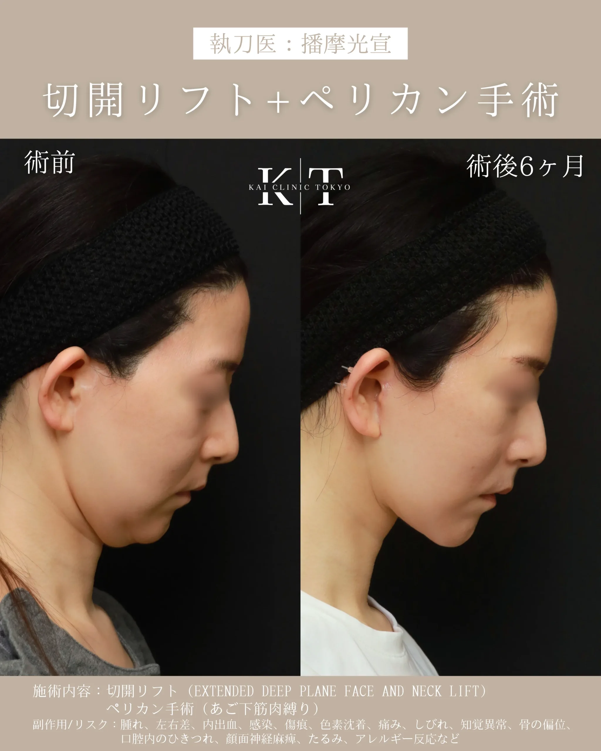 症例メディア