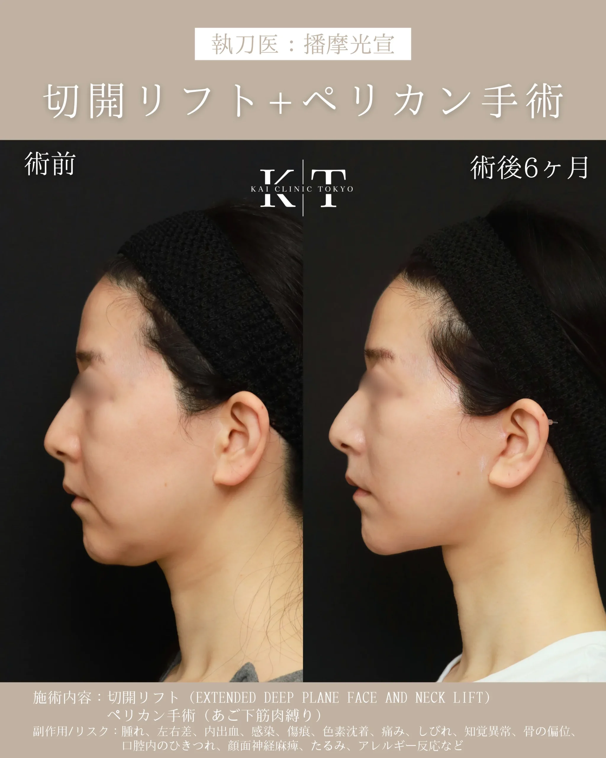 症例メディア