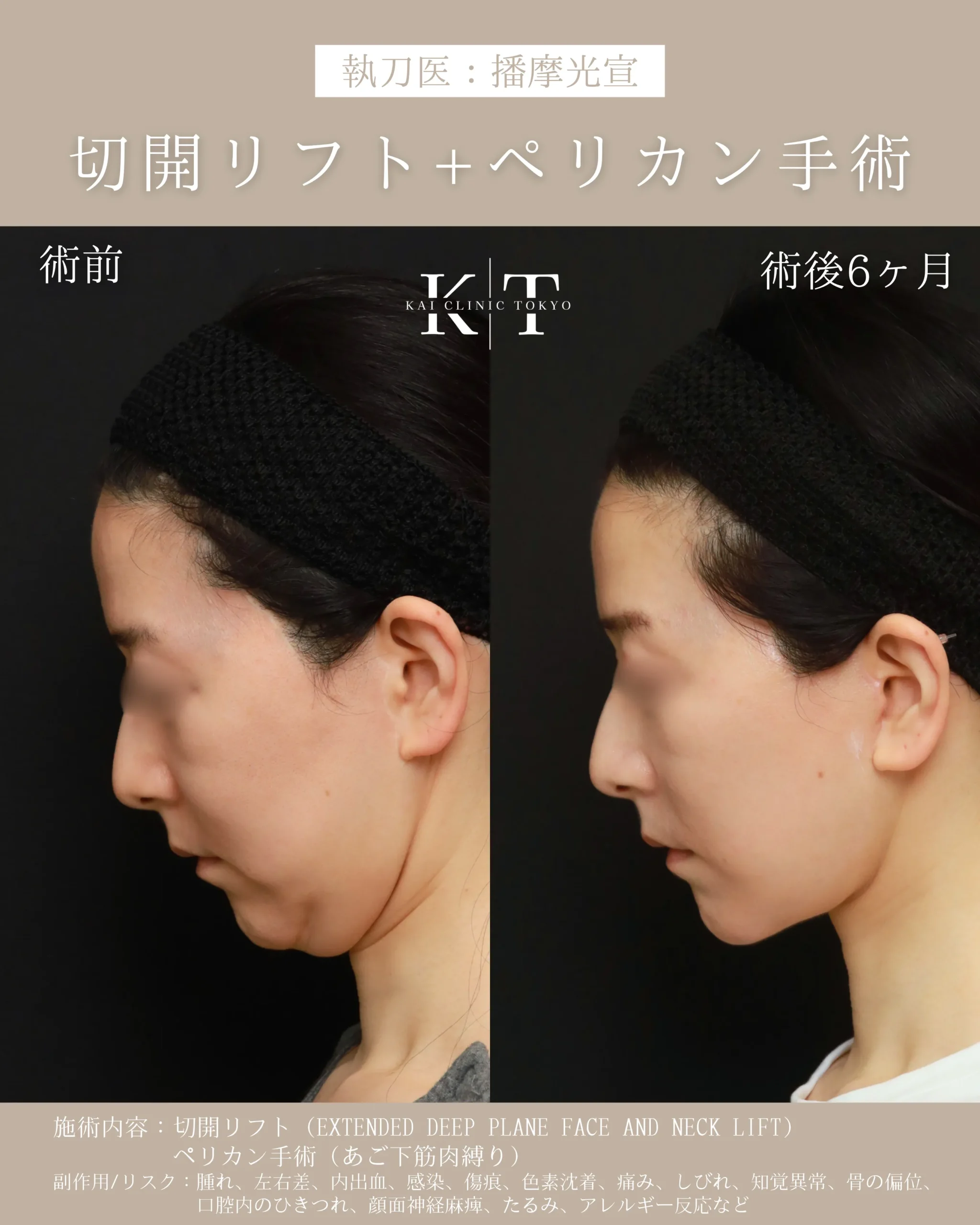 症例メディア
