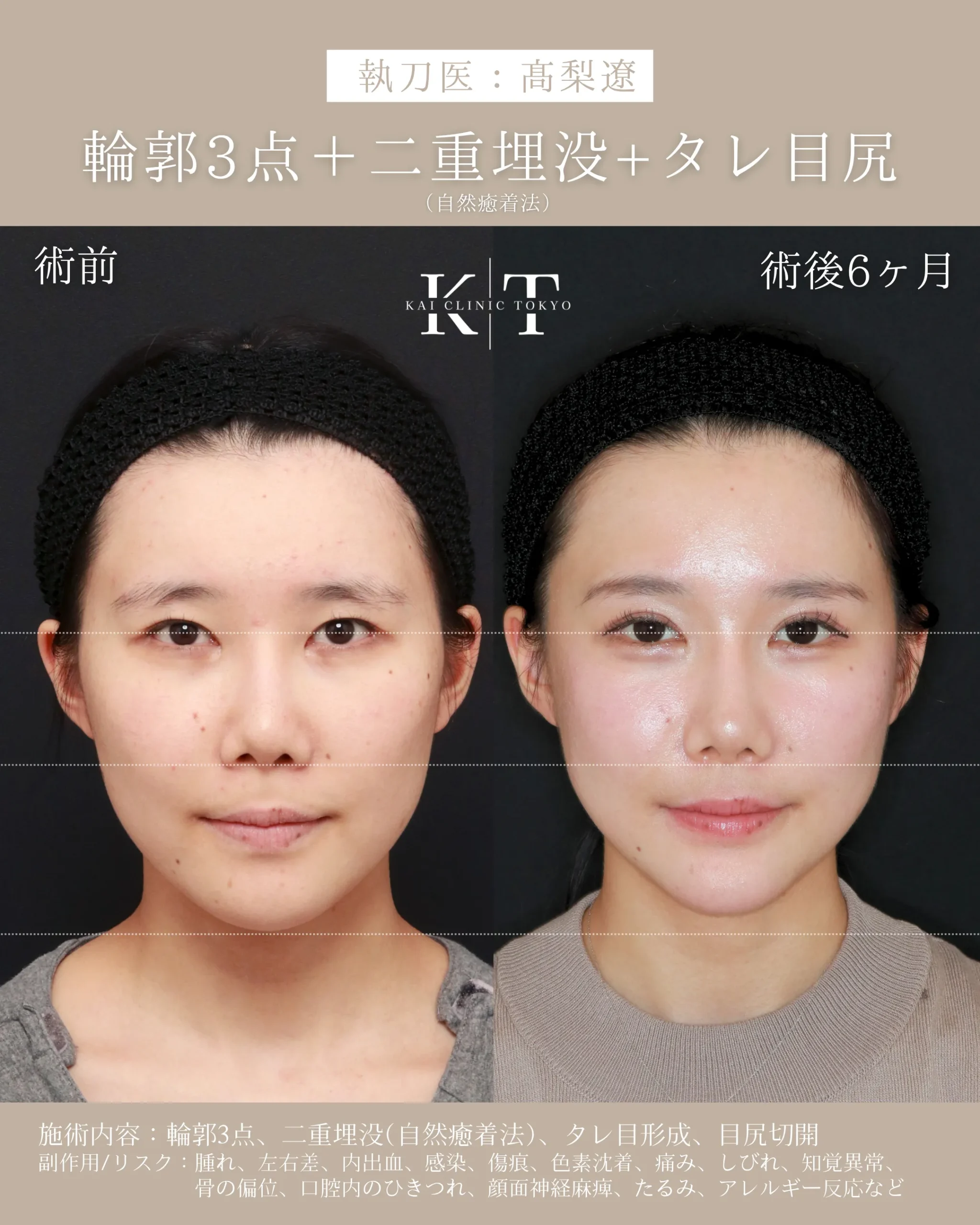 症例メディア