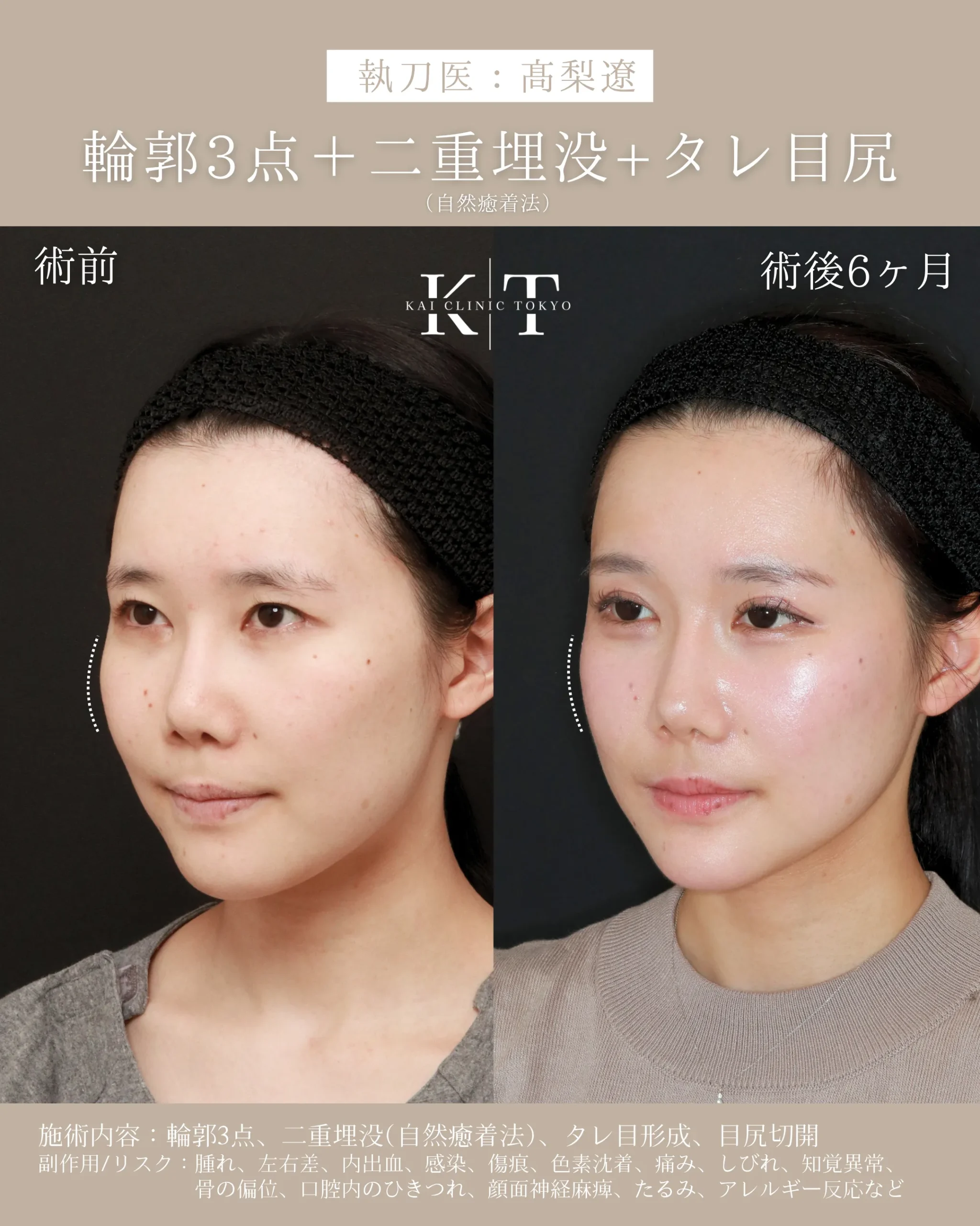症例メディア