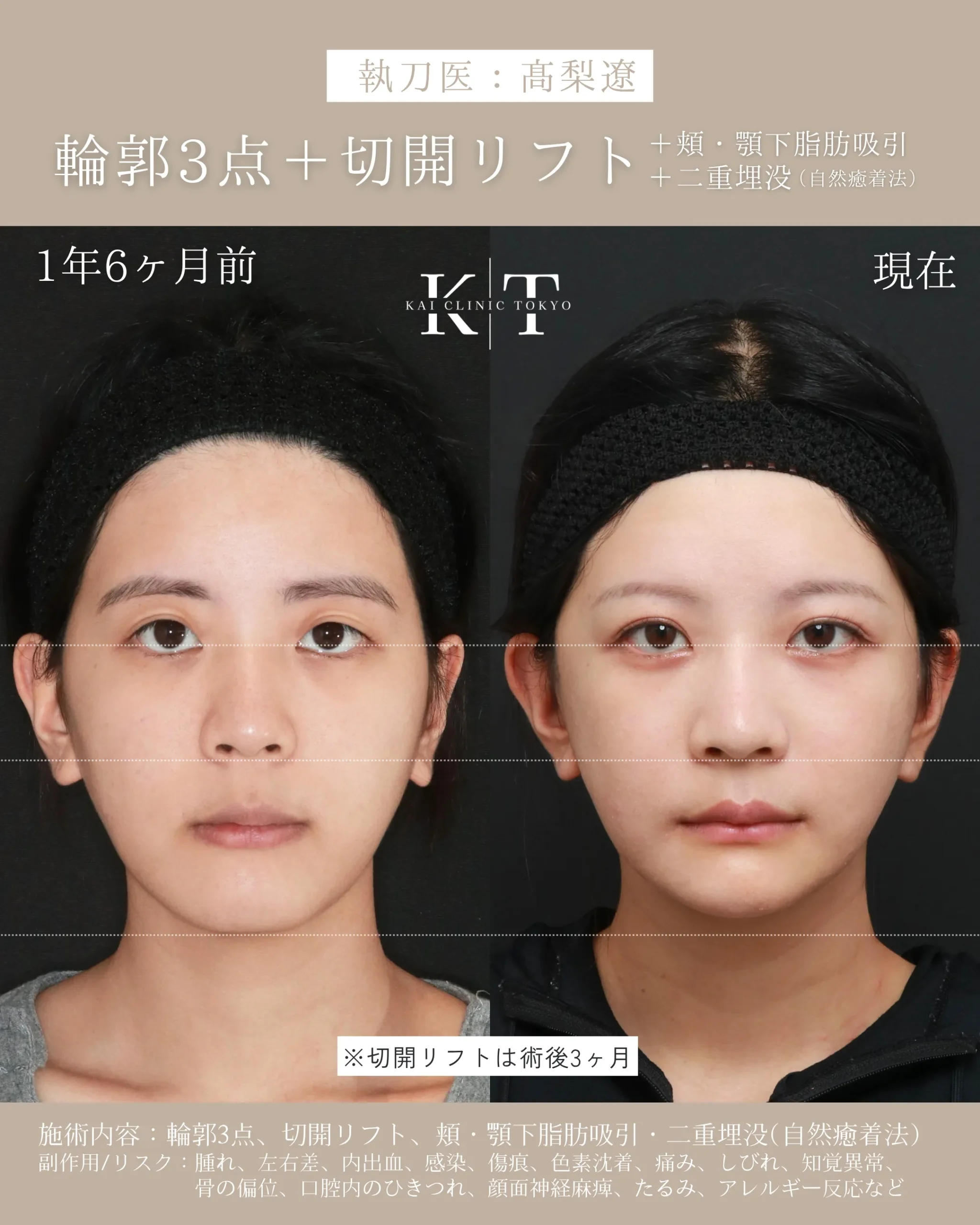 症例メディア