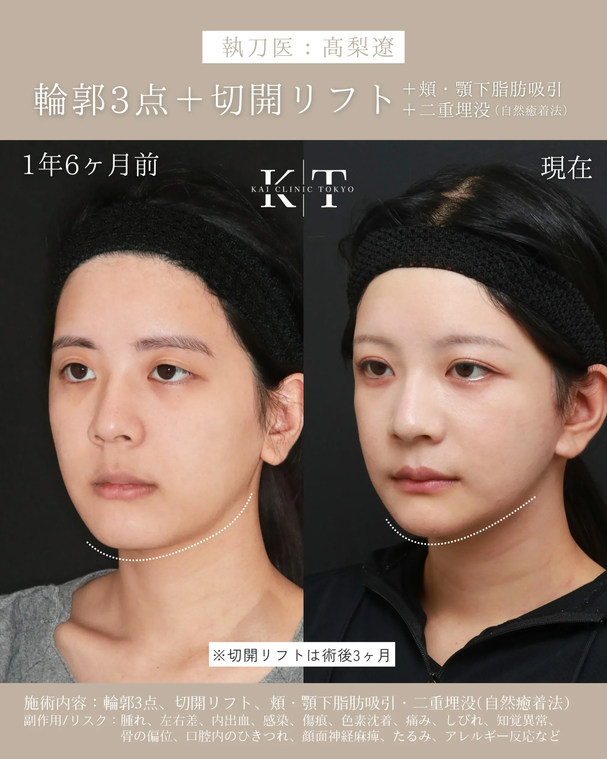 症例メディア