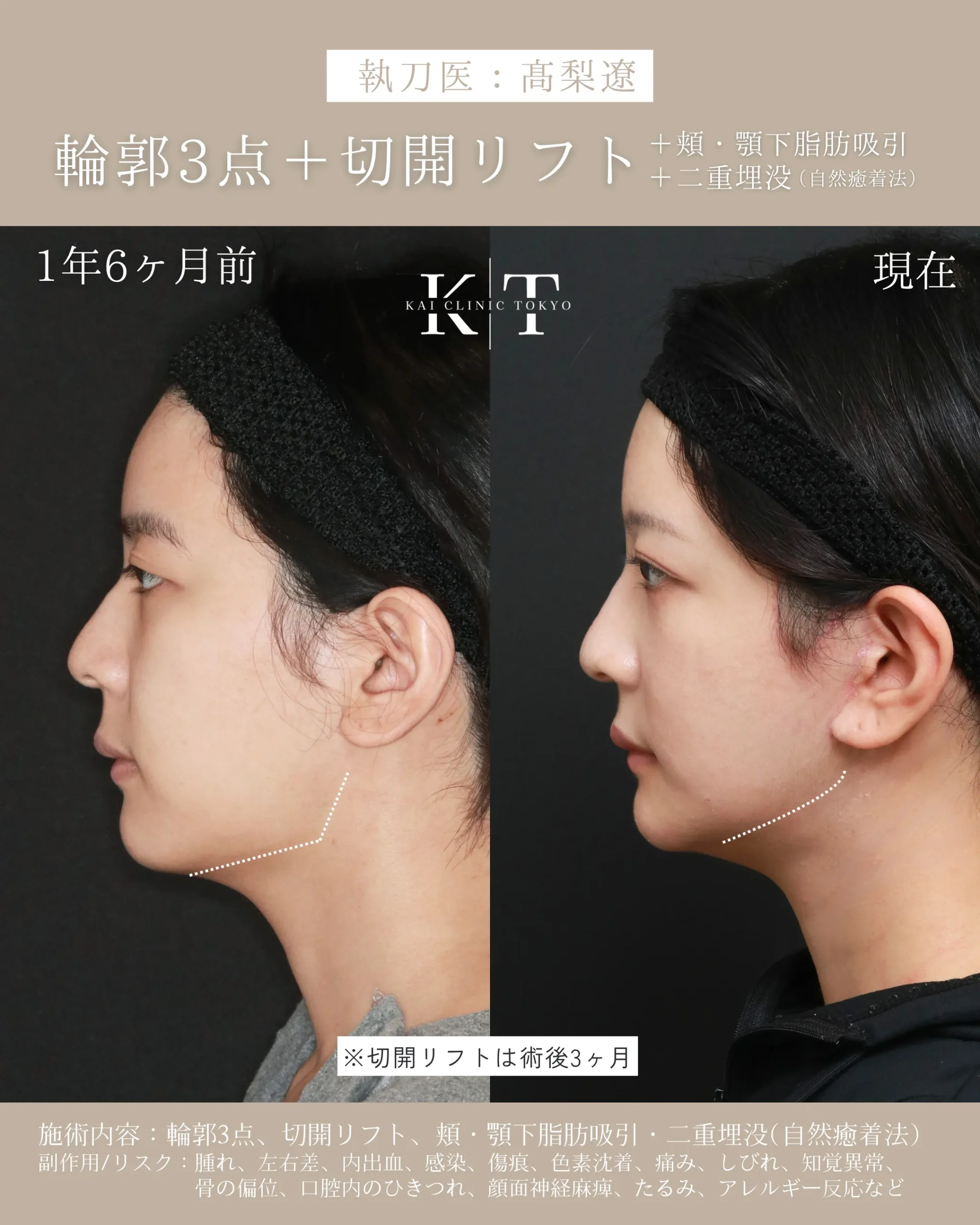 症例メディア