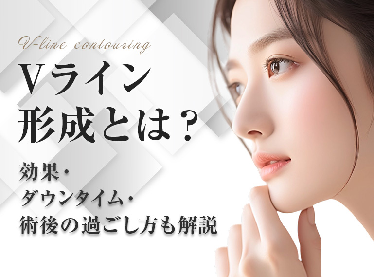 Vライン　形成