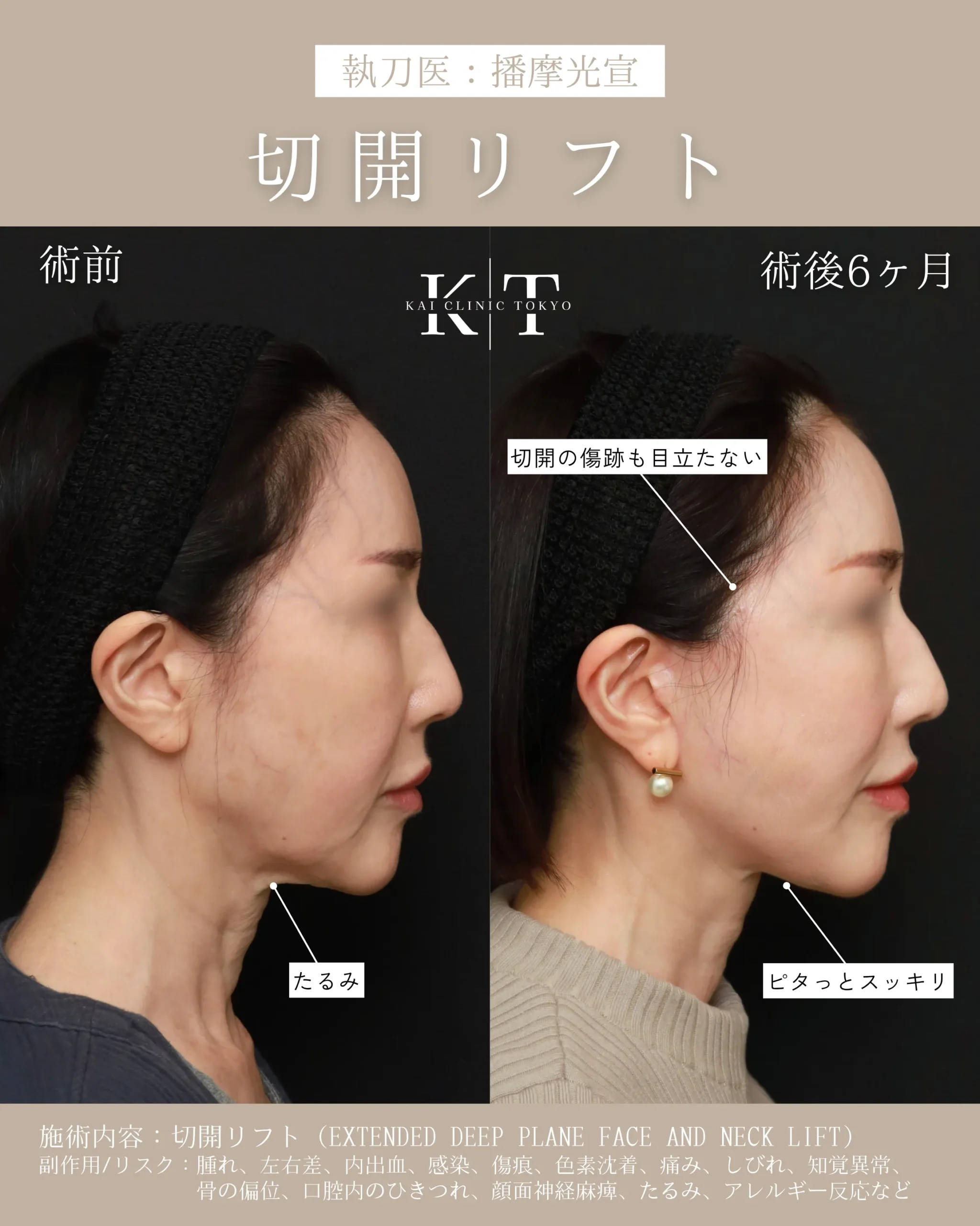 症例メディア