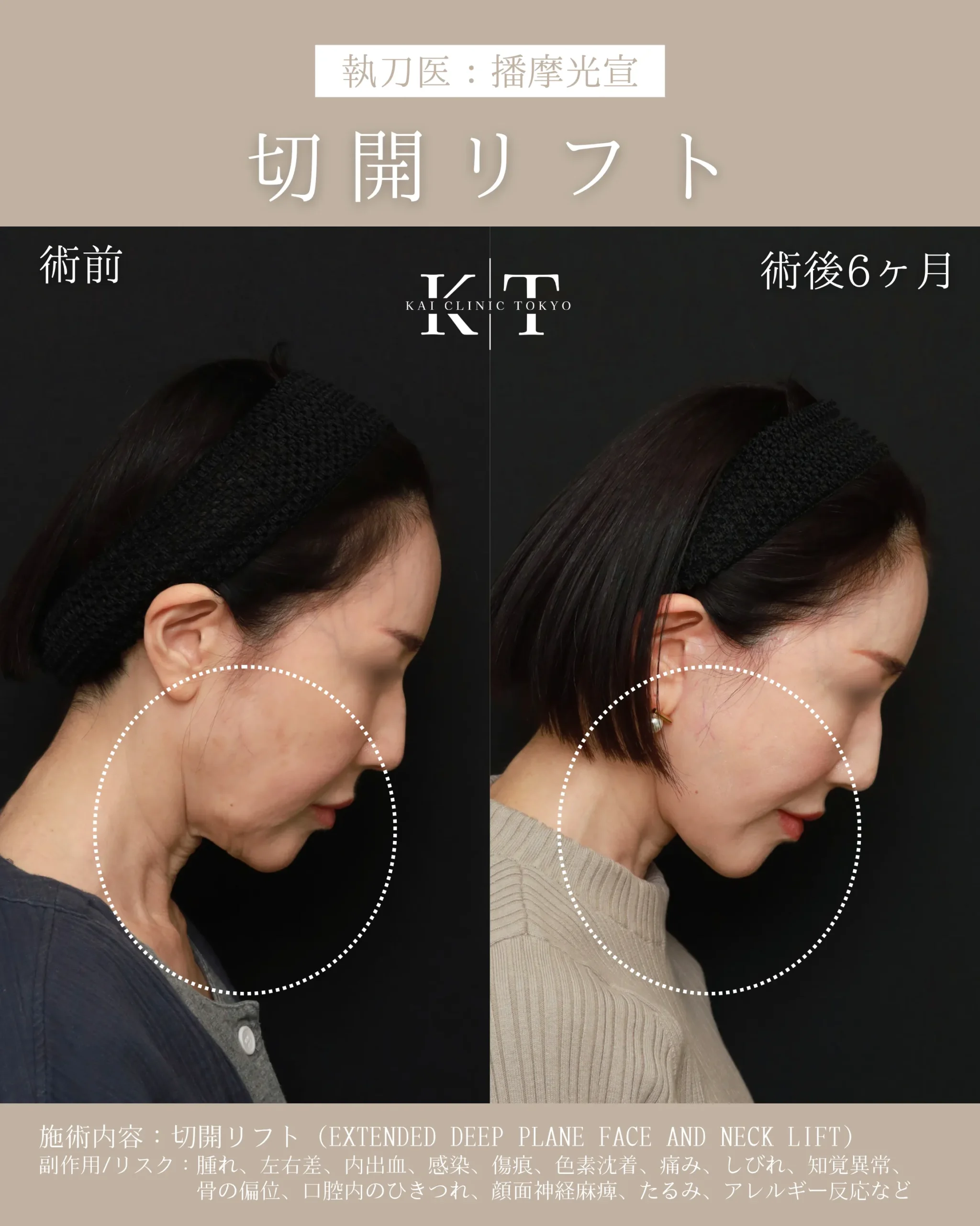 症例メディア