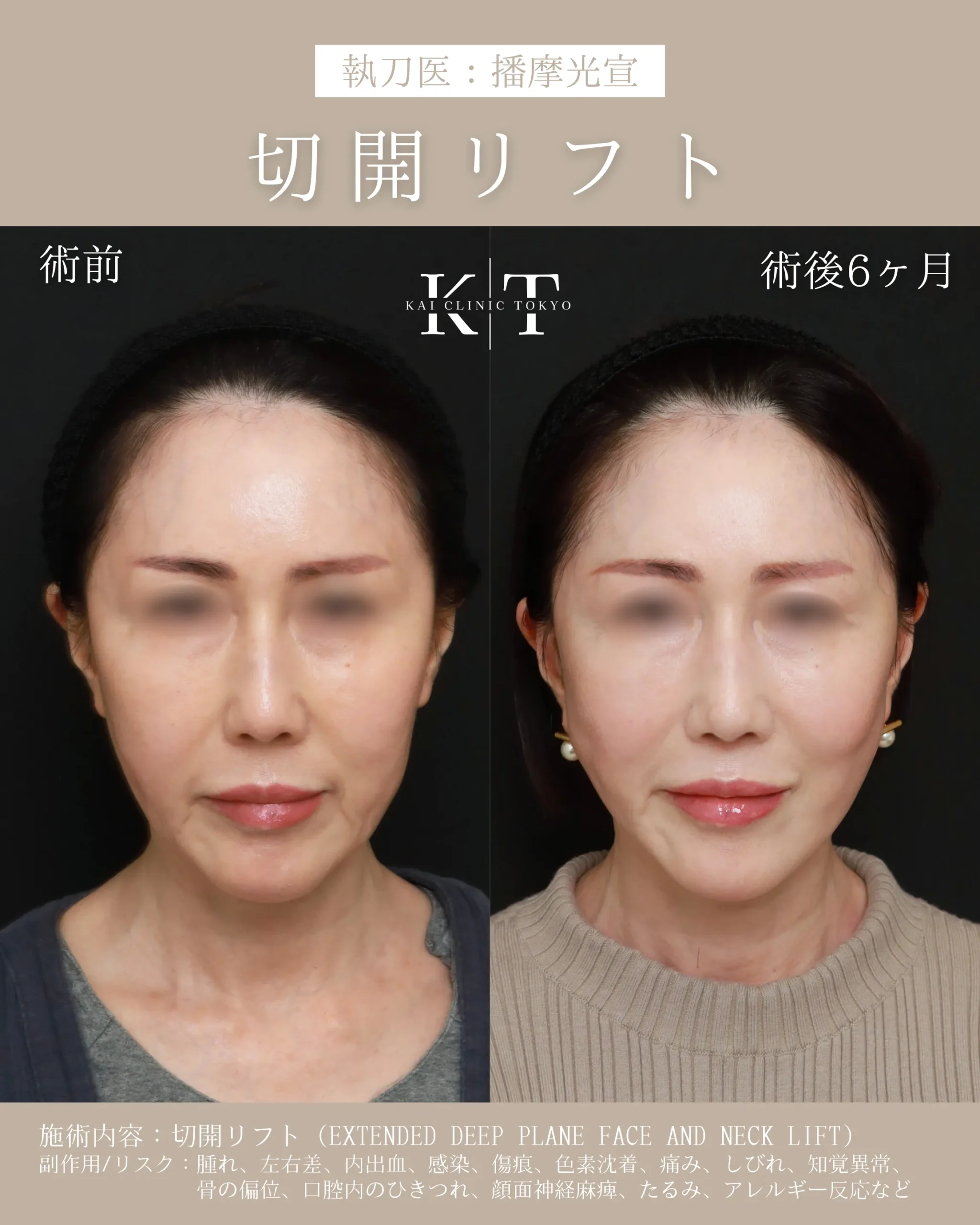 症例メディア