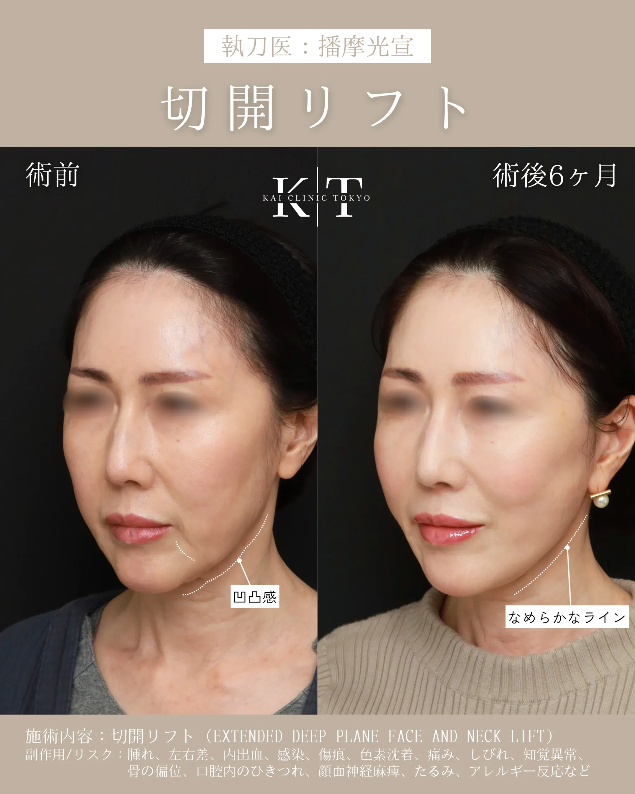 症例メディア